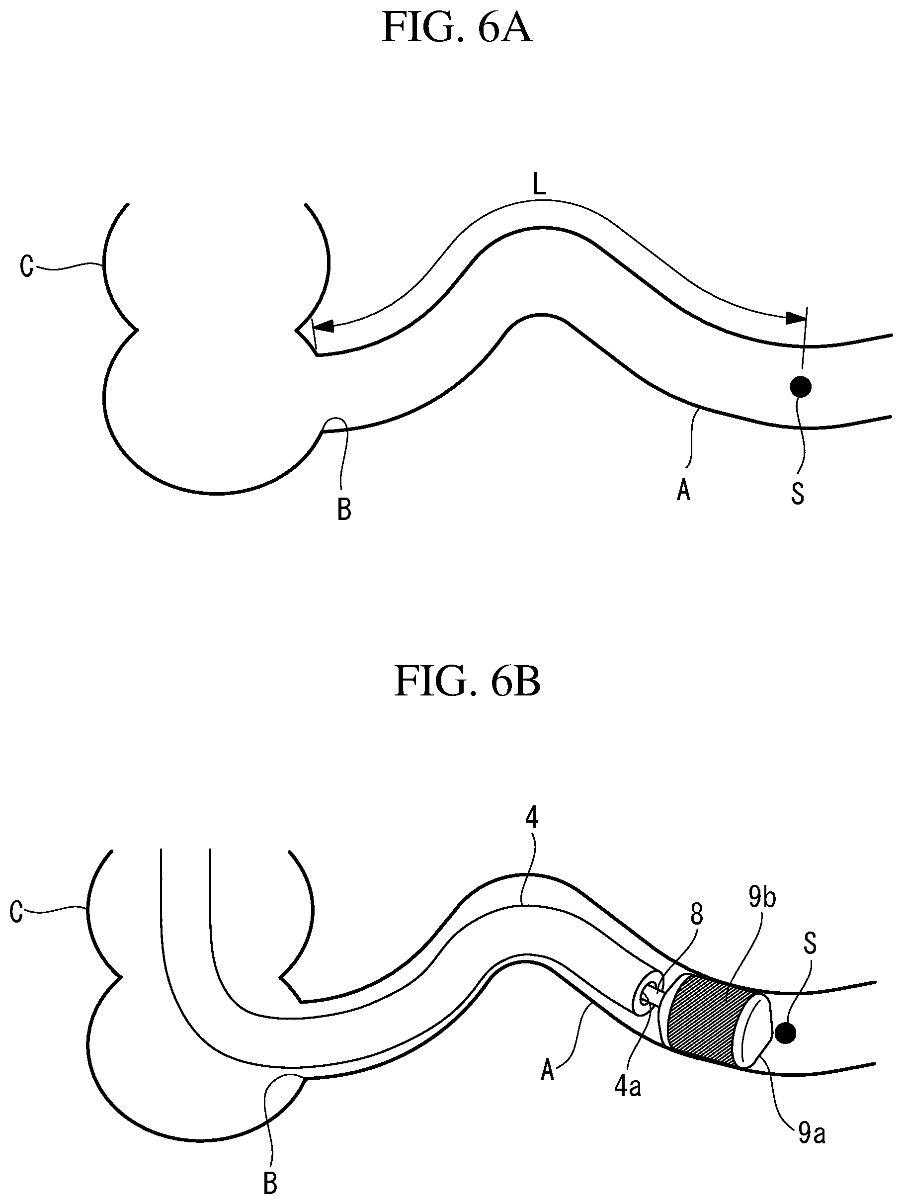 Patent US12102306 Figure 6 – Ablation-treatment-tool control device, ablation system, and ileal-mucosa ablation treatment method