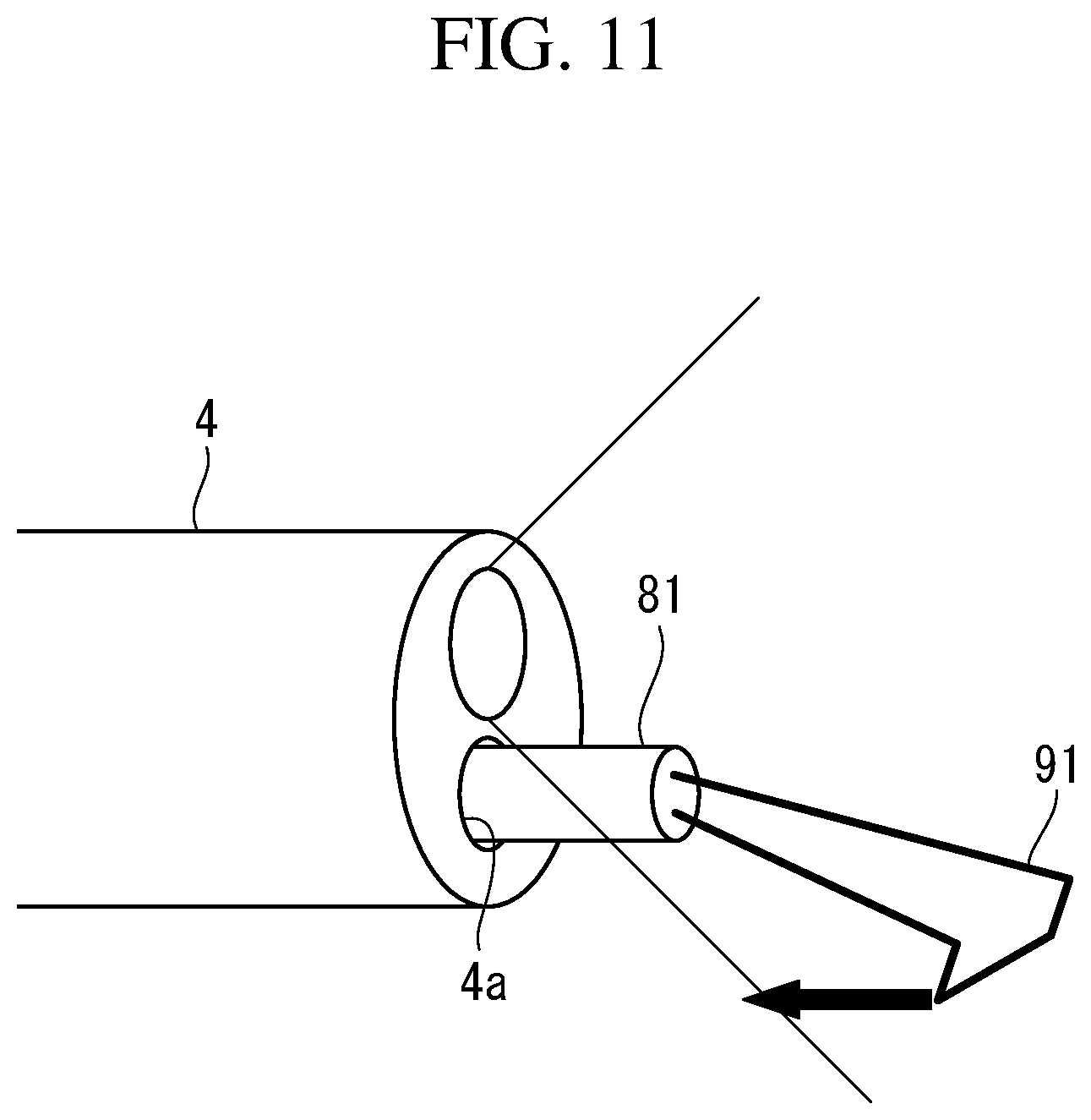 Patent US12102306 Figure 12 – Ablation-treatment-tool control device, ablation system, and ileal-mucosa ablation treatment method