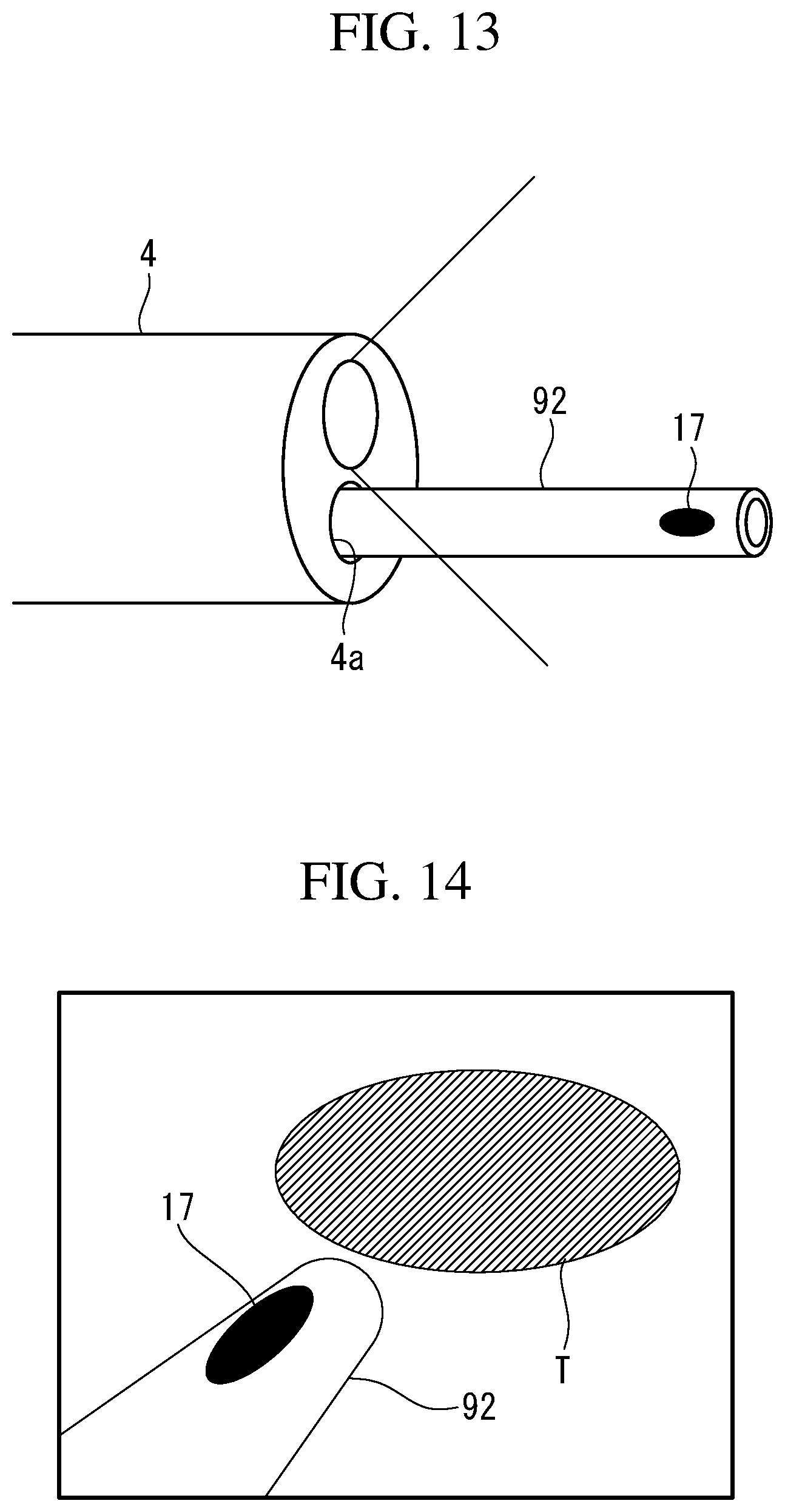 Patent US12102306 Figure 14 – Ablation-treatment-tool control device, ablation system, and ileal-mucosa ablation treatment method