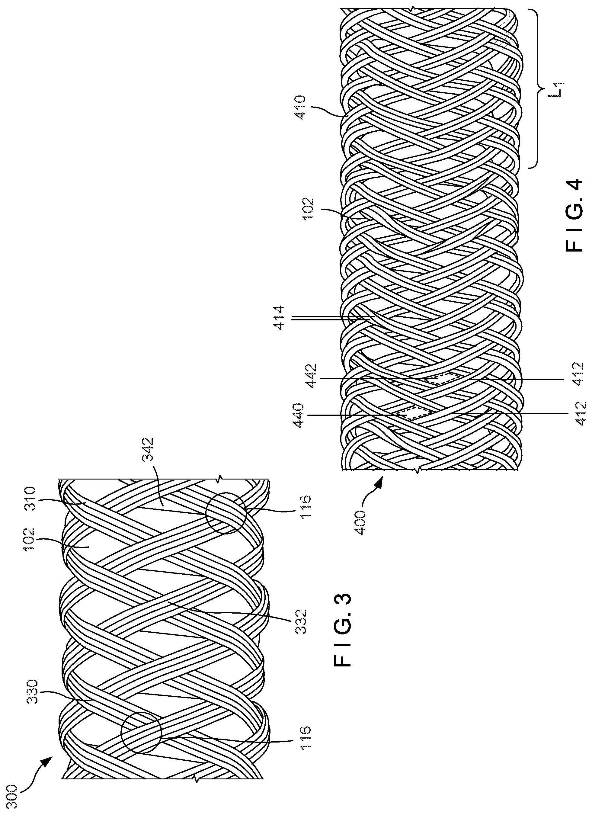 Patent US12102308 Figure 2 – Braided hemostasis shaft for improved torsional response