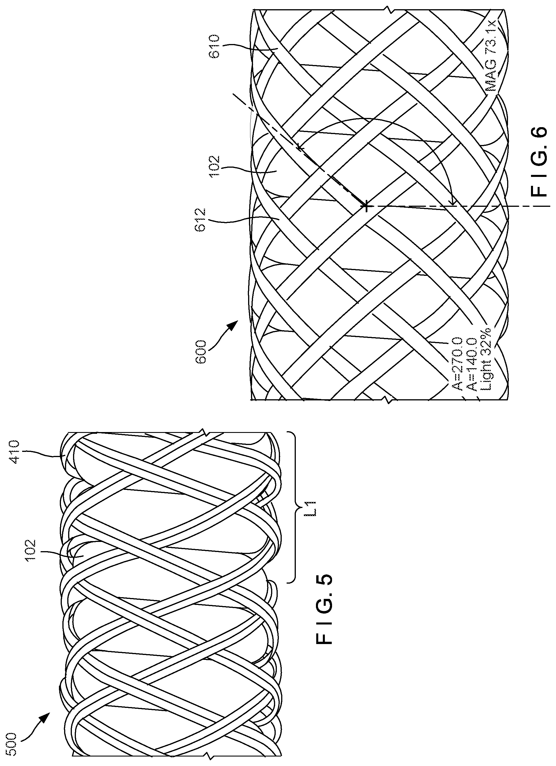Patent US12102308 Figure 3 – Braided hemostasis shaft for improved torsional response