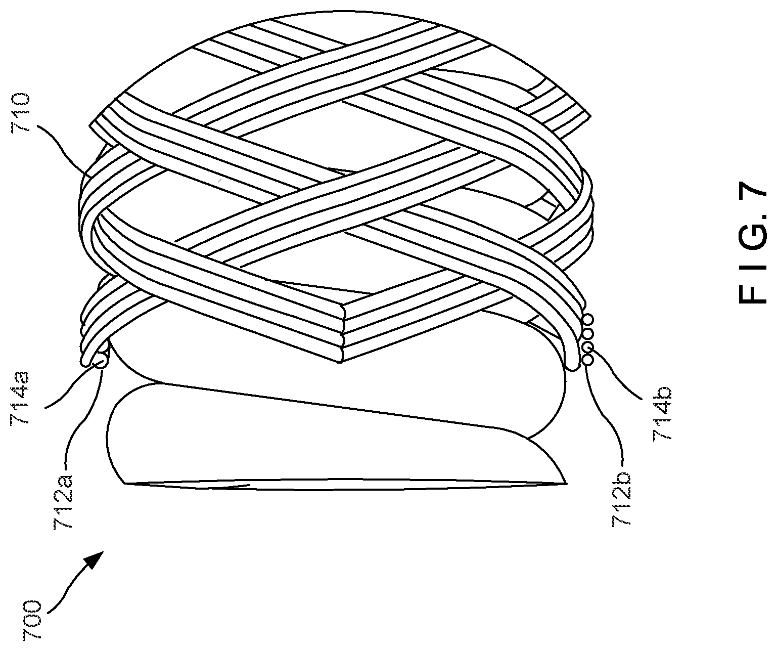 Patent US12102308 Figure 4 – Braided hemostasis shaft for improved torsional response