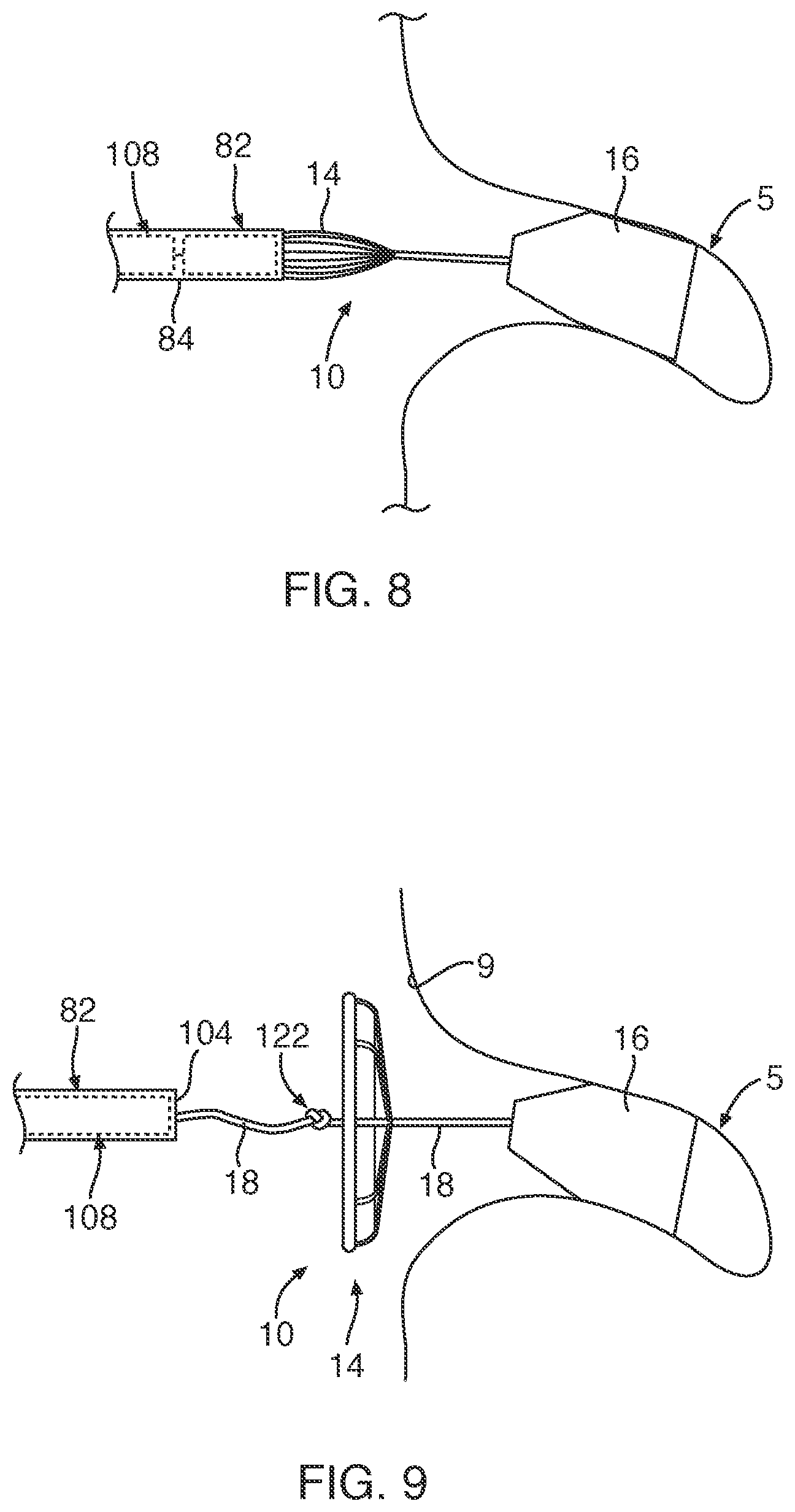 Patent US12102309 Figure 5 – Medical device and system for occluding a tissue opening and method thereof
