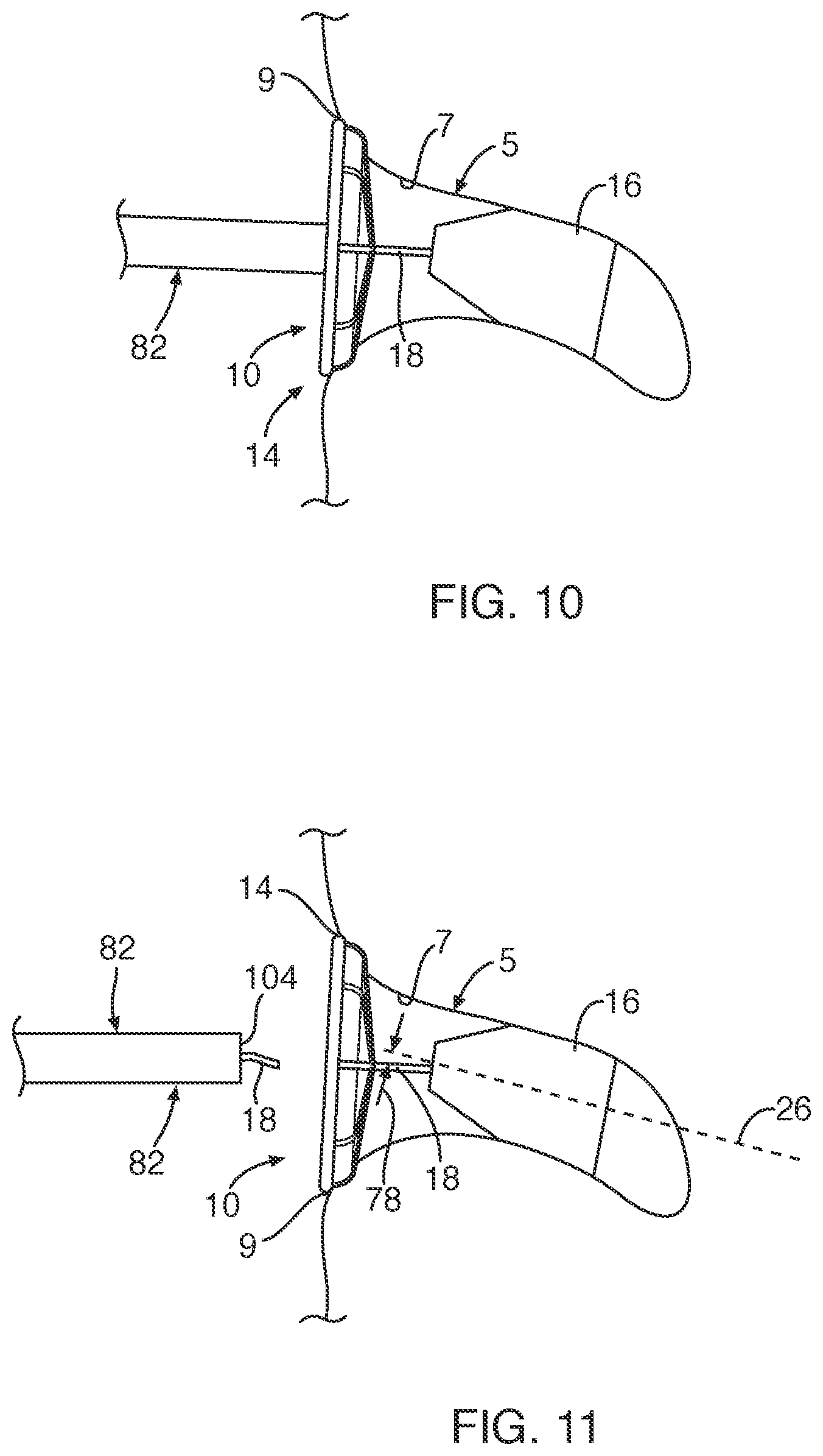 Patent US12102309 Figure 6 – Medical device and system for occluding a tissue opening and method thereof