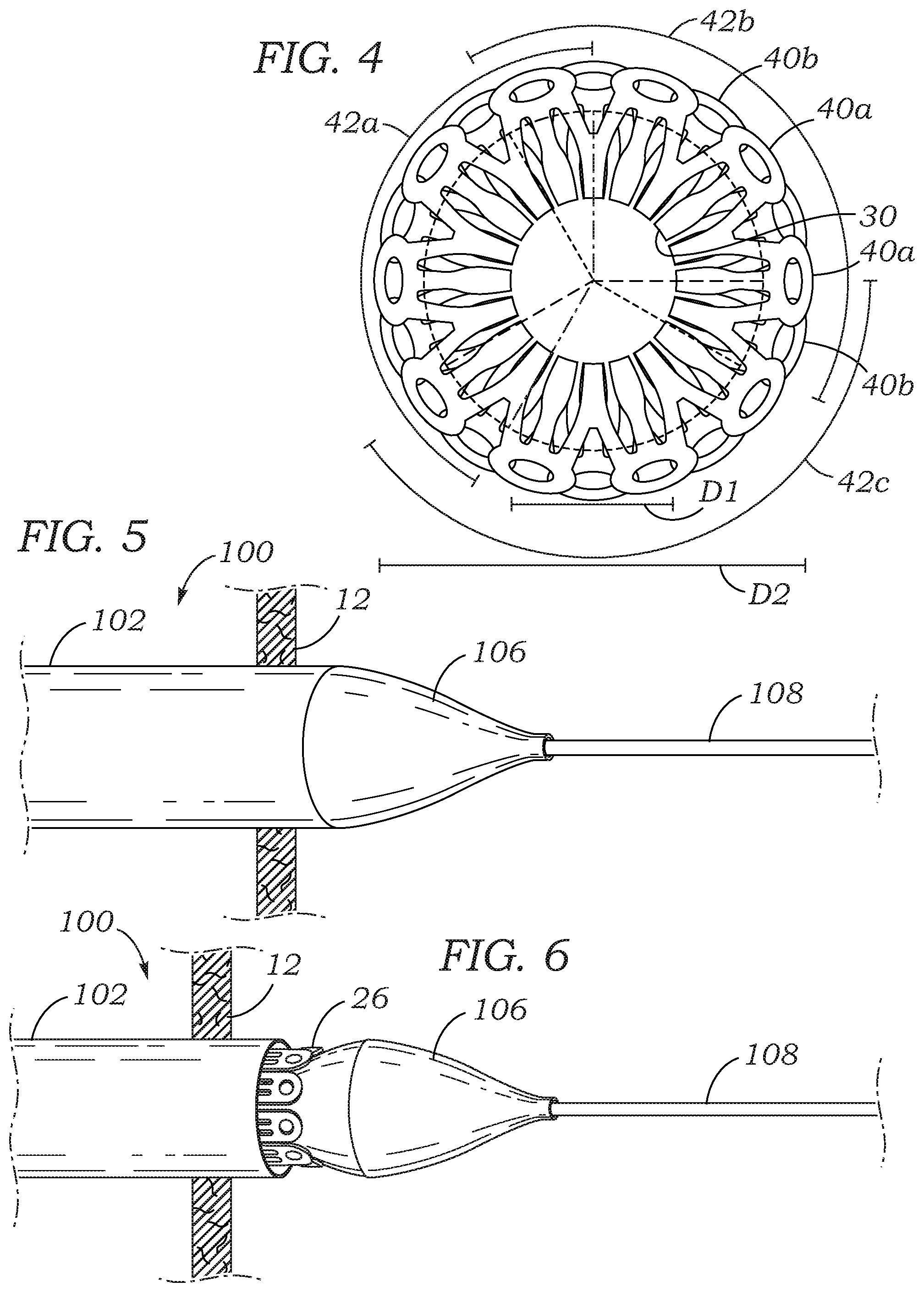 Patent US12102310 Figure 2 – Trans-septal closure and port device