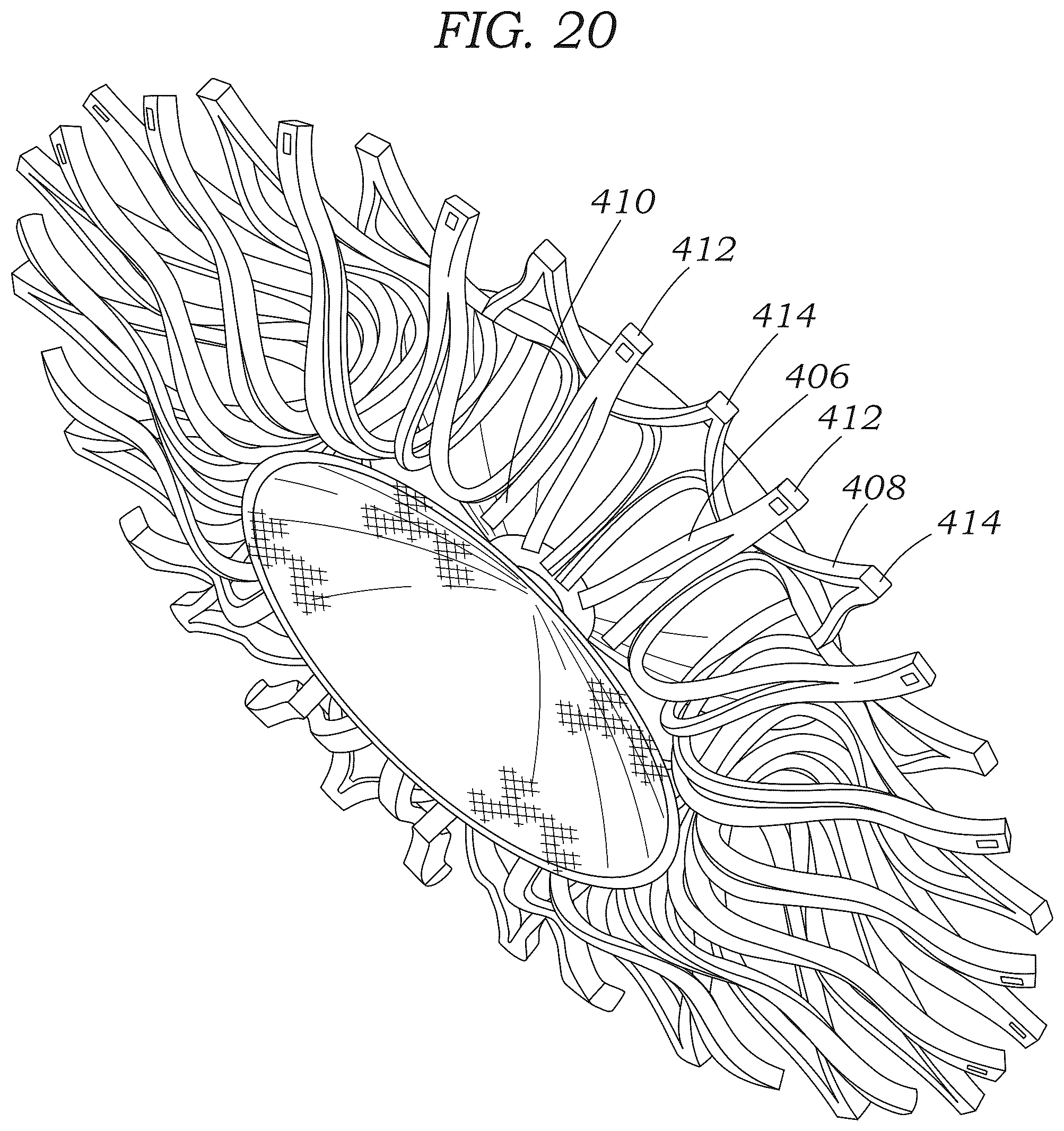 Patent US12102310 Figure 8 – Trans-septal closure and port device