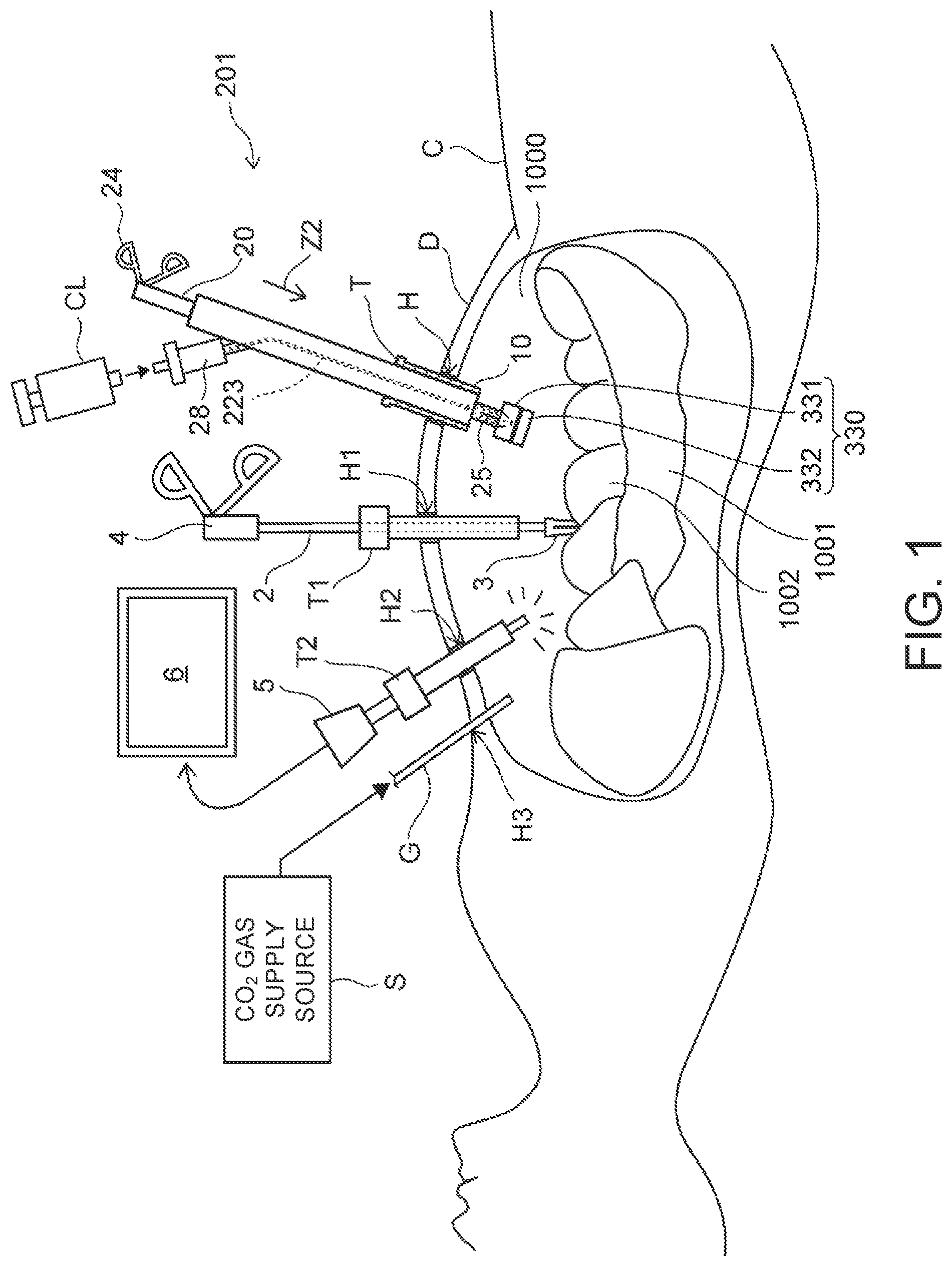 Patent US12102311 Figure 1 – Organ retraction device