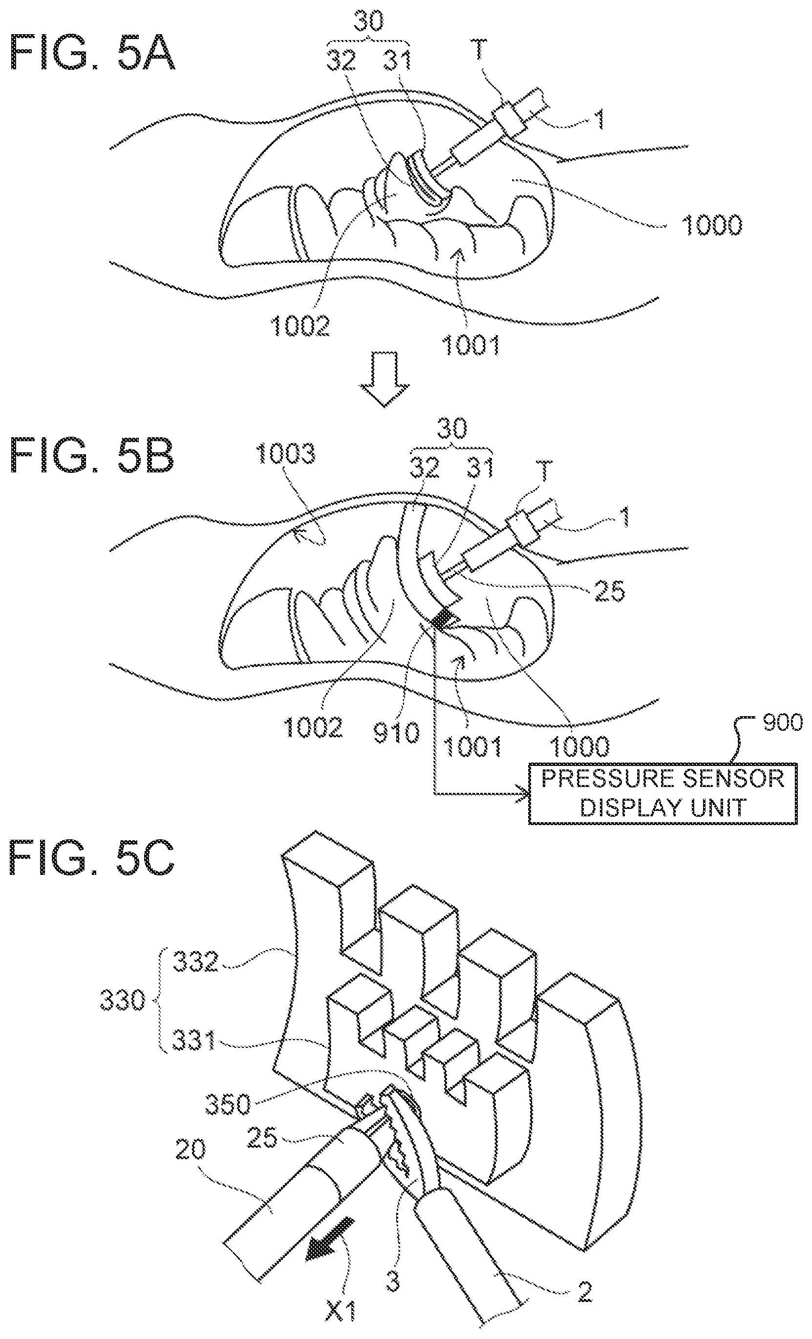 Patent US12102311 Figure 4 – Organ retraction device