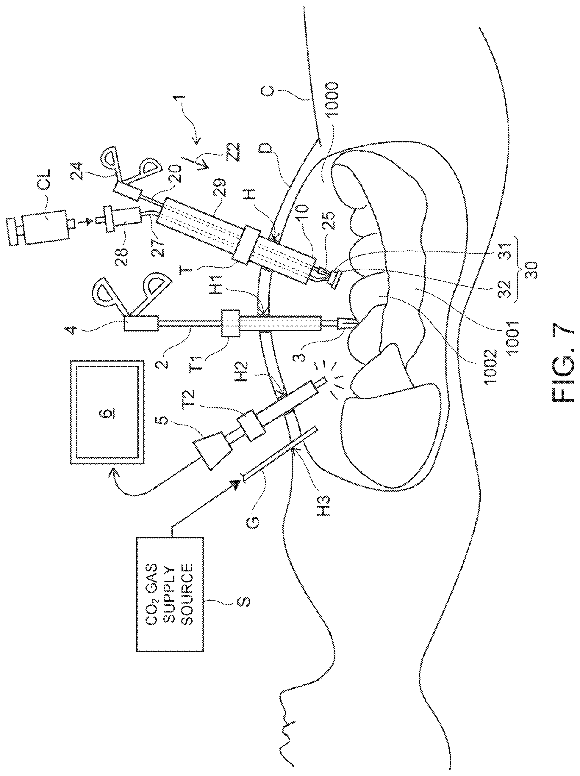 Patent US12102311 Figure 6 – Organ retraction device