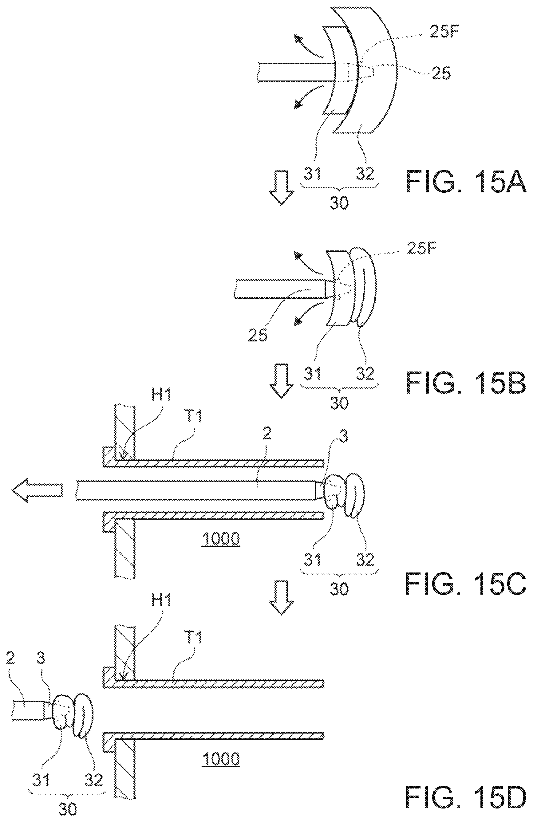 Patent US12102311 Figure 13 – Organ retraction device