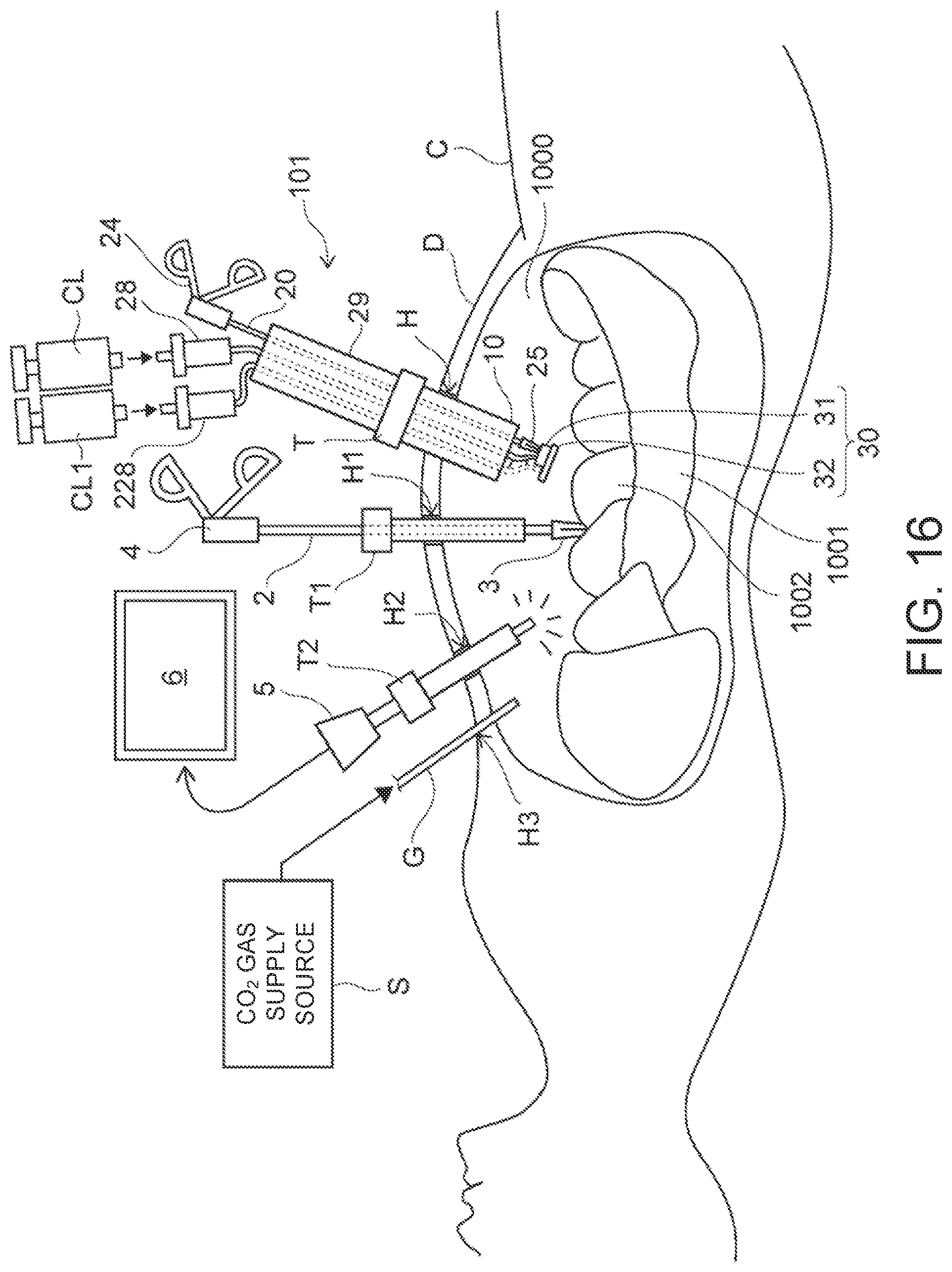 Patent US12102311 Figure 14 – Organ retraction device