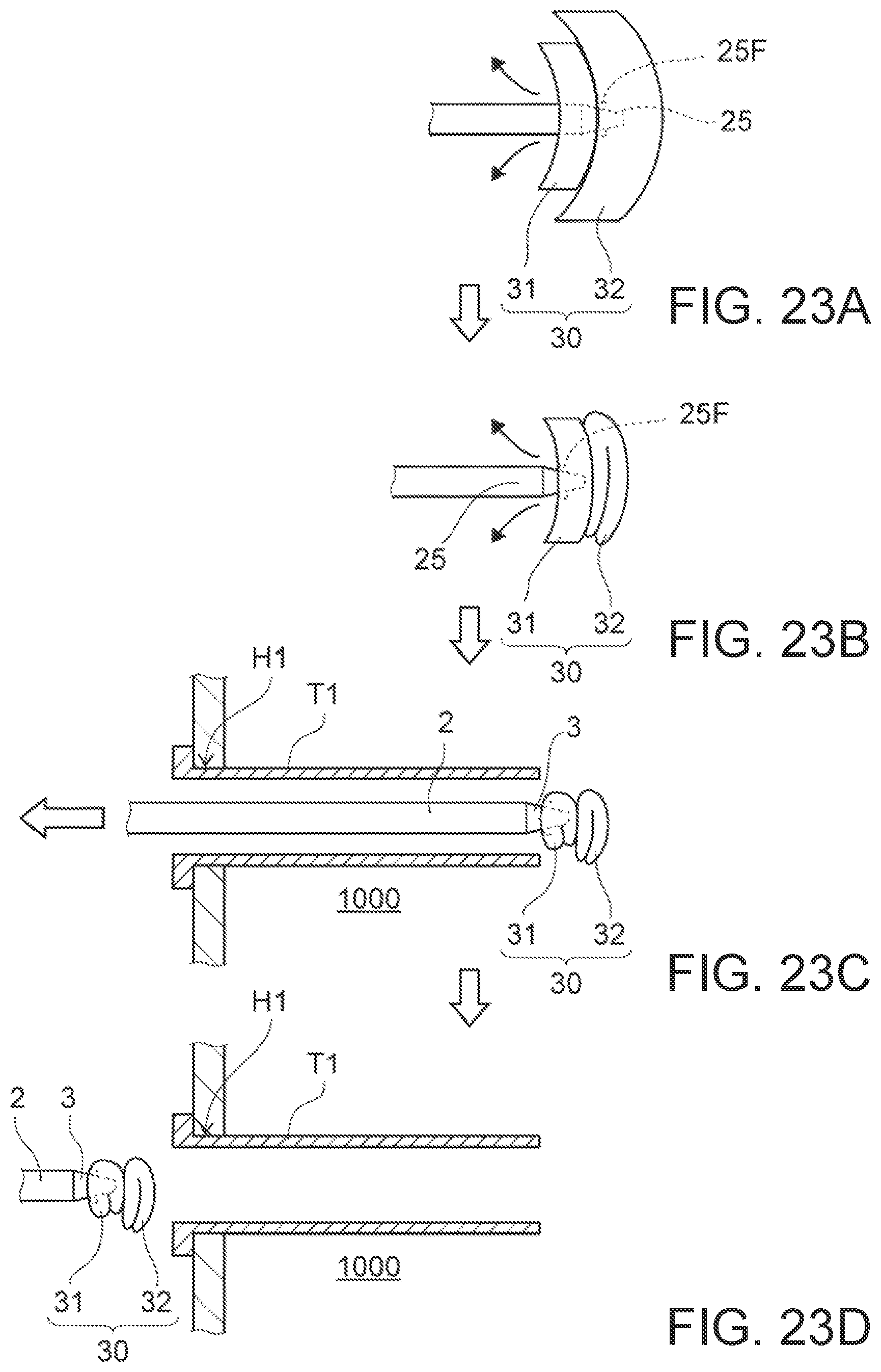 Patent US12102311 Figure 20 – Organ retraction device