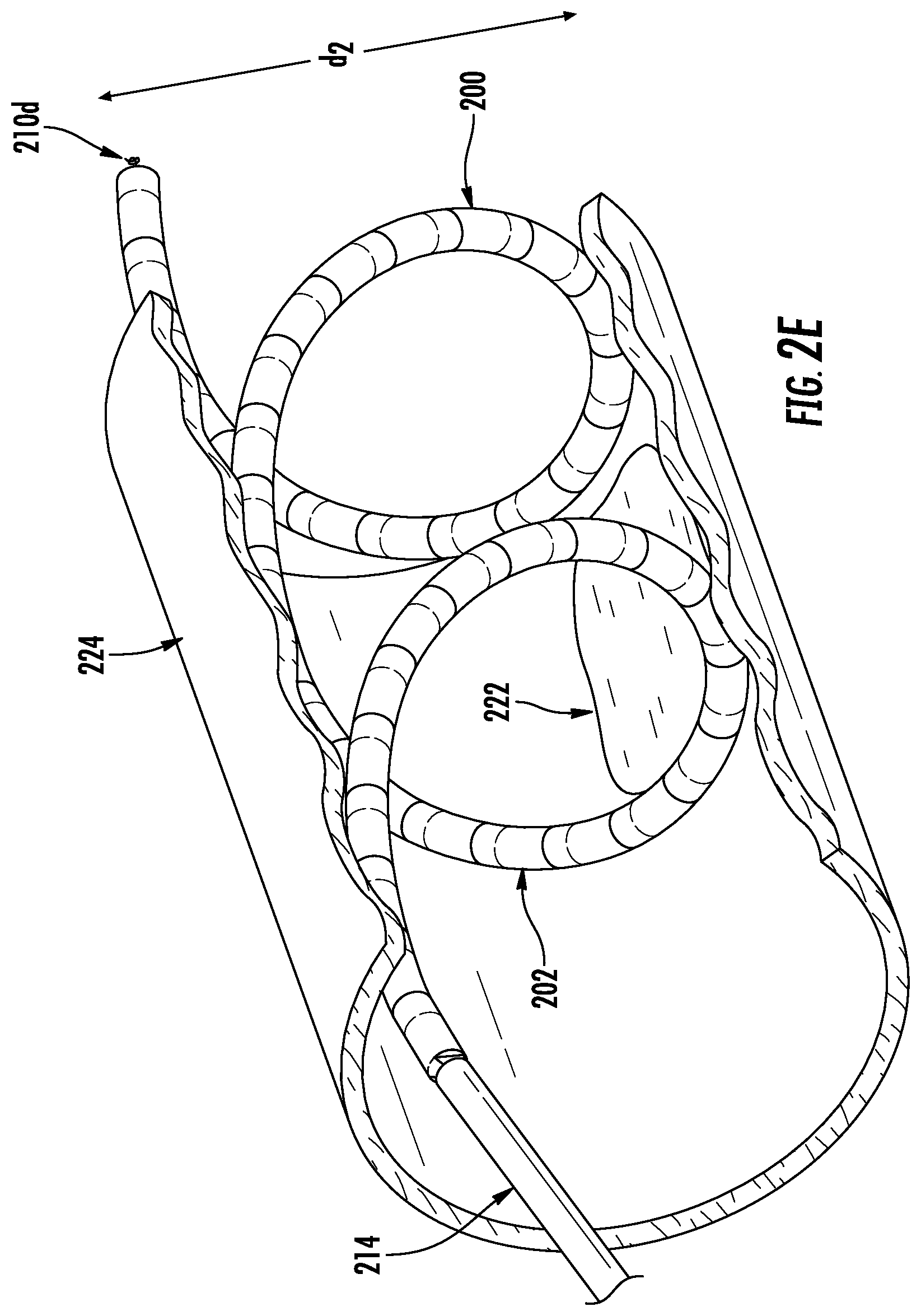 Patent US12102312 Figure 5 – Expandable devices, systems, and methods