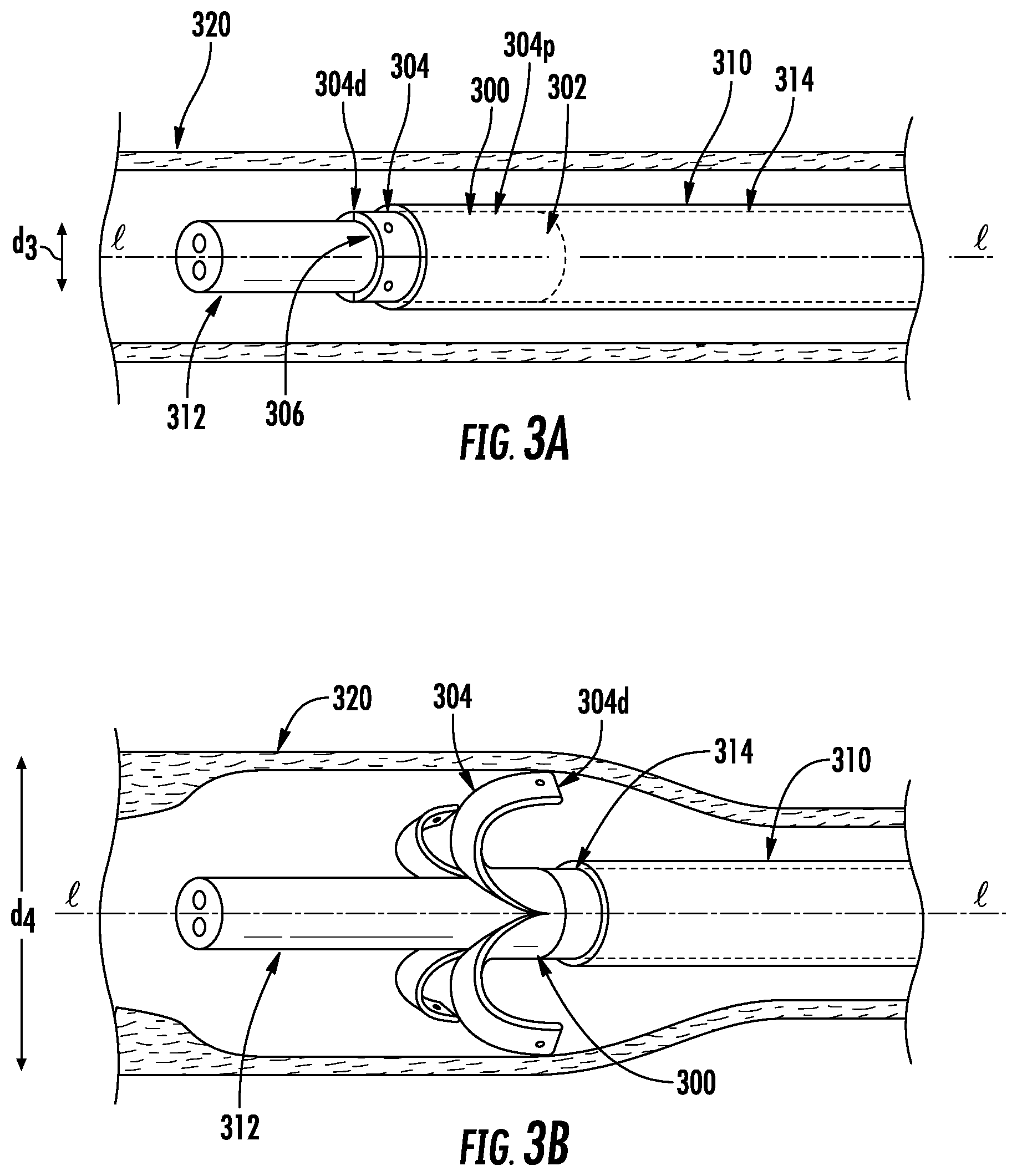 Patent US12102312 Figure 6 – Expandable devices, systems, and methods