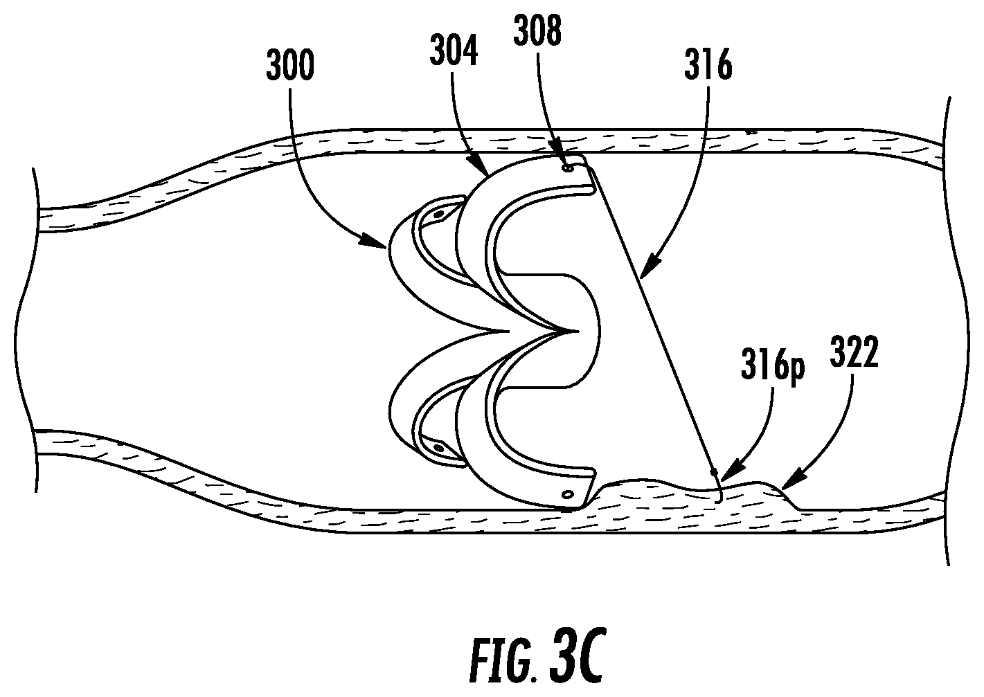 Patent US12102312 Figure 7 – Expandable devices, systems, and methods