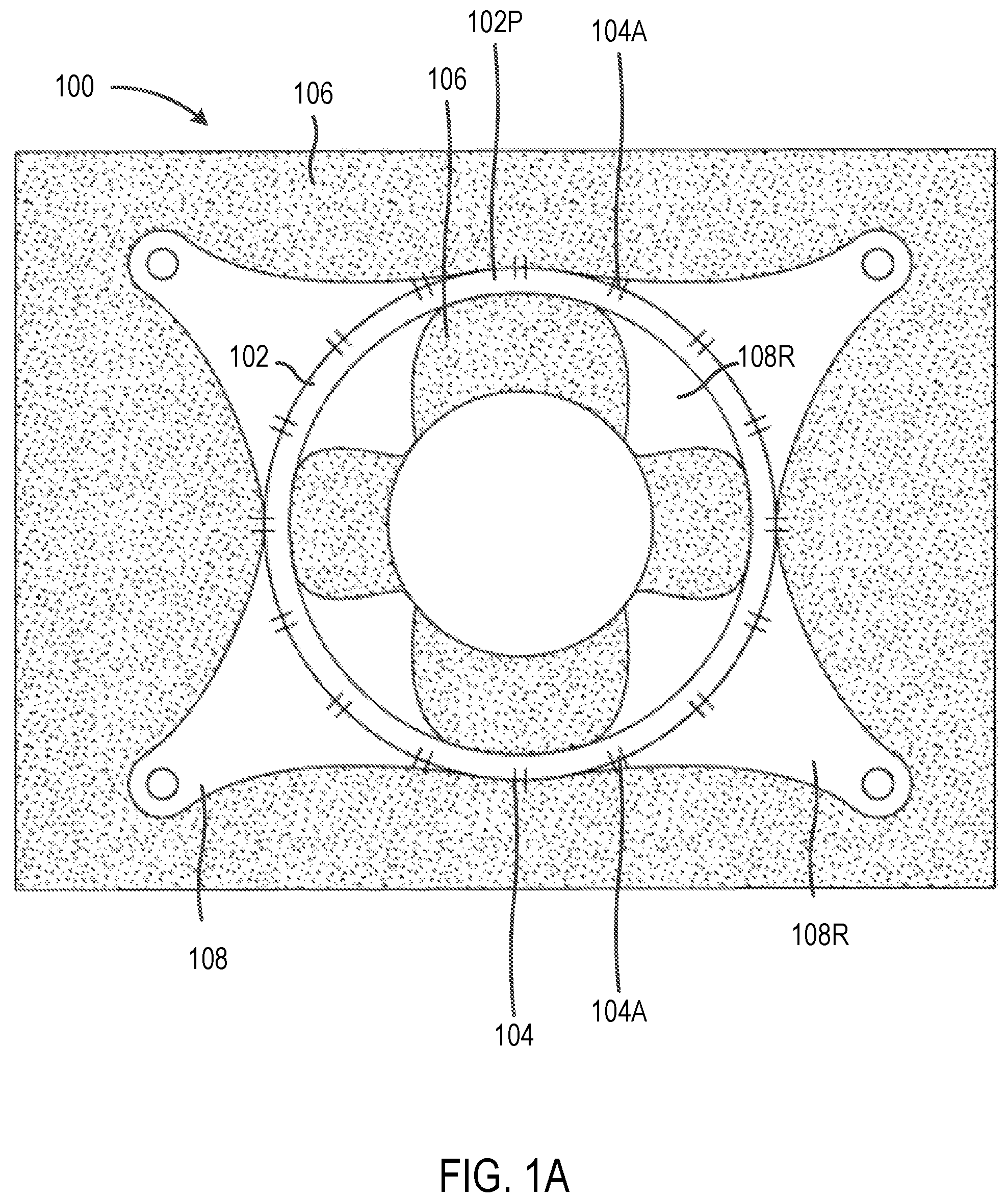 Patent US12102314 Figure 1 – Systems and methods including an adjustable retractor frame