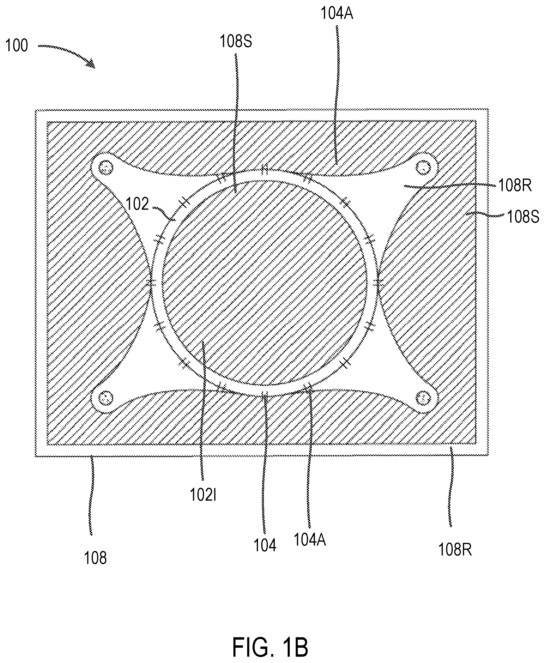 Patent US12102314 Figure 2 – Systems and methods including an adjustable retractor frame
