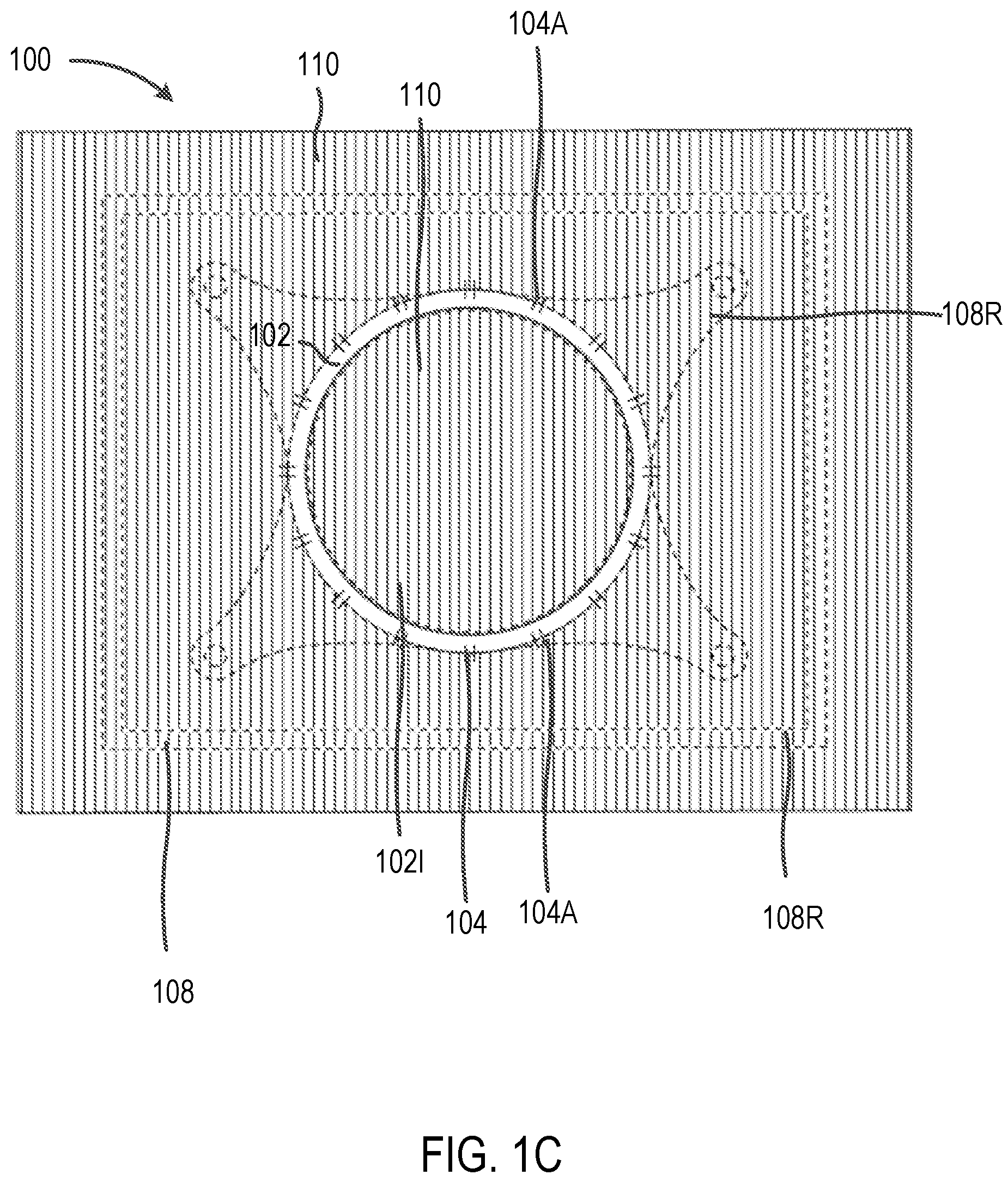 Patent US12102314 Figure 3 – Systems and methods including an adjustable retractor frame
