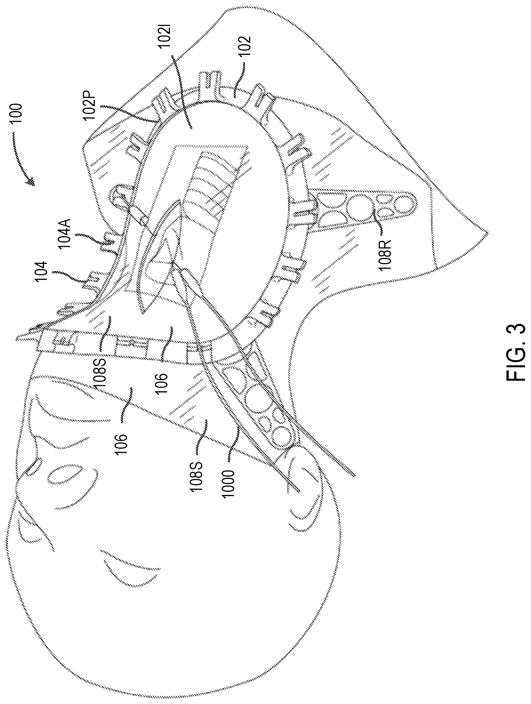 Patent US12102314 Figure 10 – Systems and methods including an adjustable retractor frame