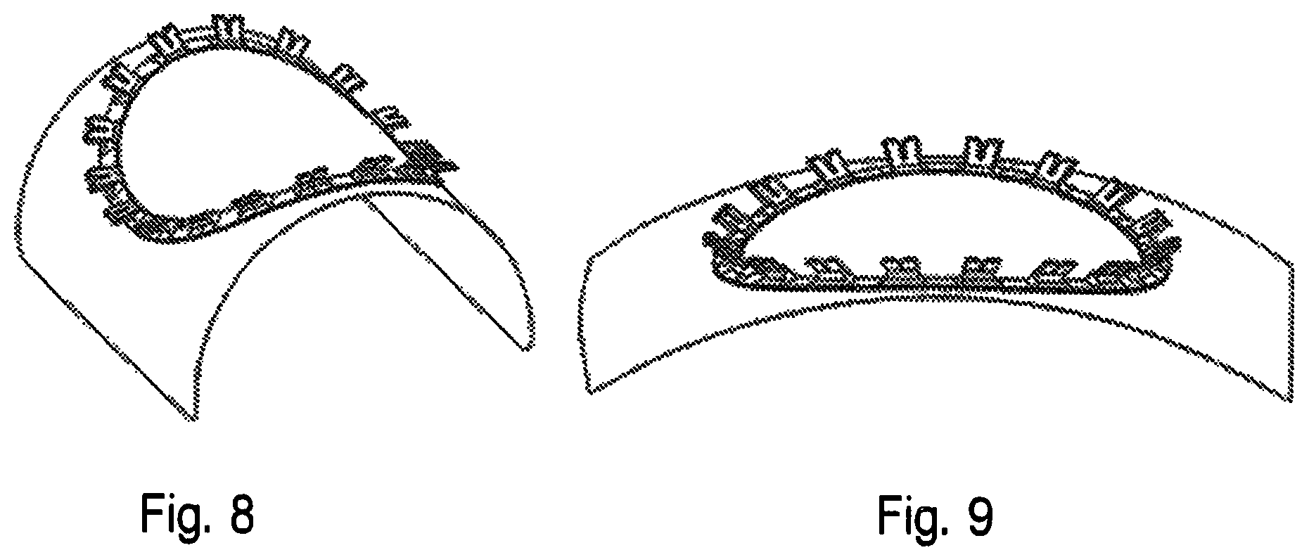 Patent US12102314 Figure 15 – Systems and methods including an adjustable retractor frame