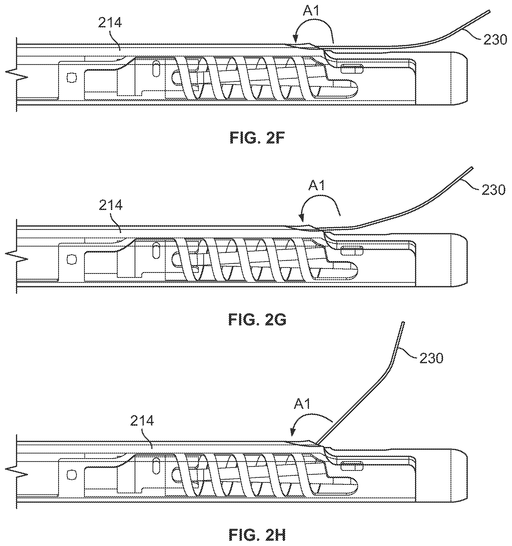 Patent US12102316 Figure 6 – Devices and methods of visualizing and determining depth of penetration in cardiac tissue