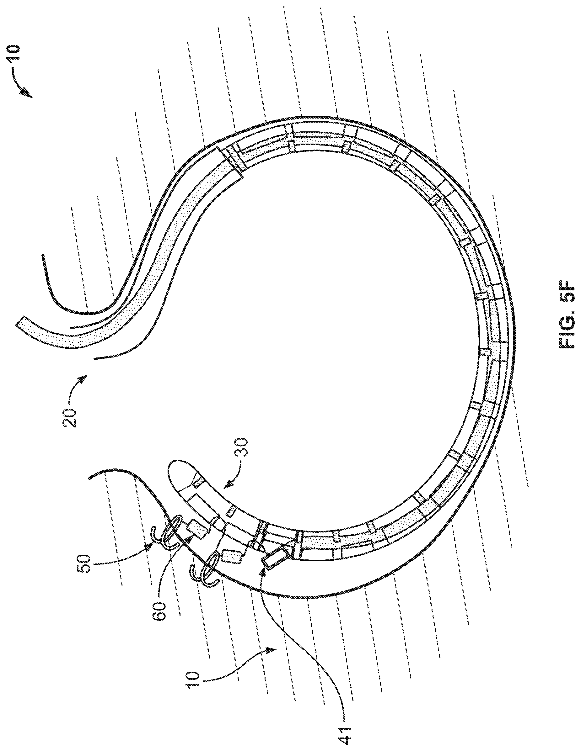Patent US12102316 Figure 17 – Devices and methods of visualizing and determining depth of penetration in cardiac tissue