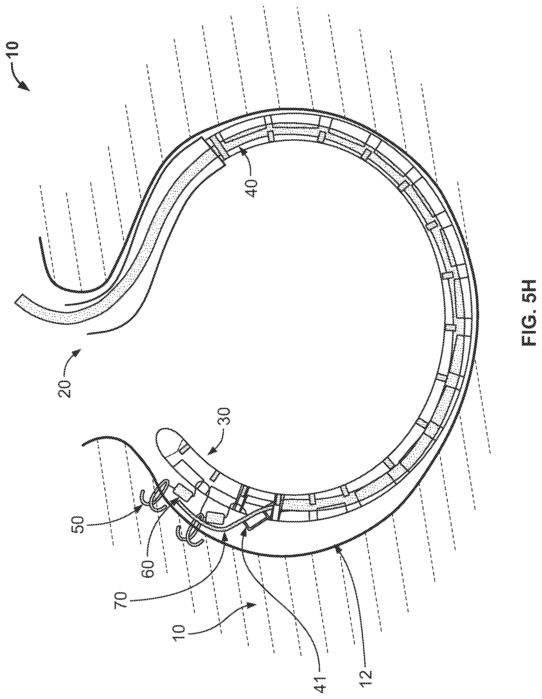Patent US12102316 Figure 19 – Devices and methods of visualizing and determining depth of penetration in cardiac tissue