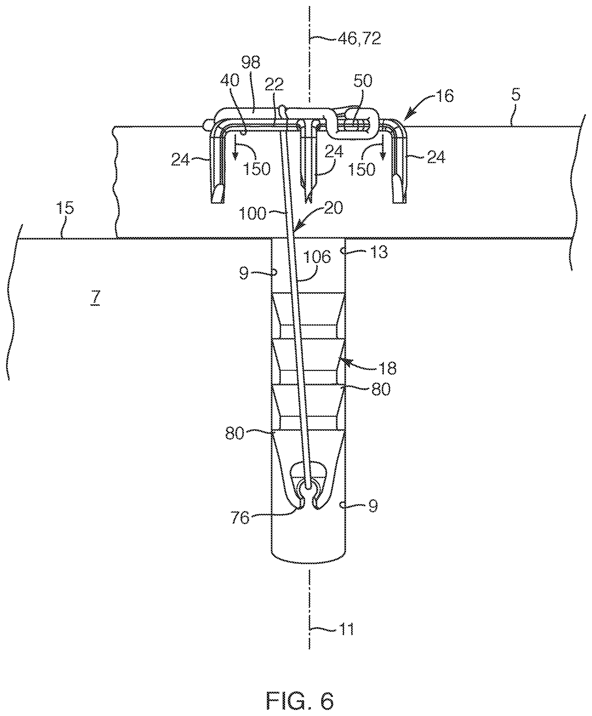 Patent US12102317 Figure 6 – Devices, systems, and methods for repairing soft tissue and attaching soft tissue to bone