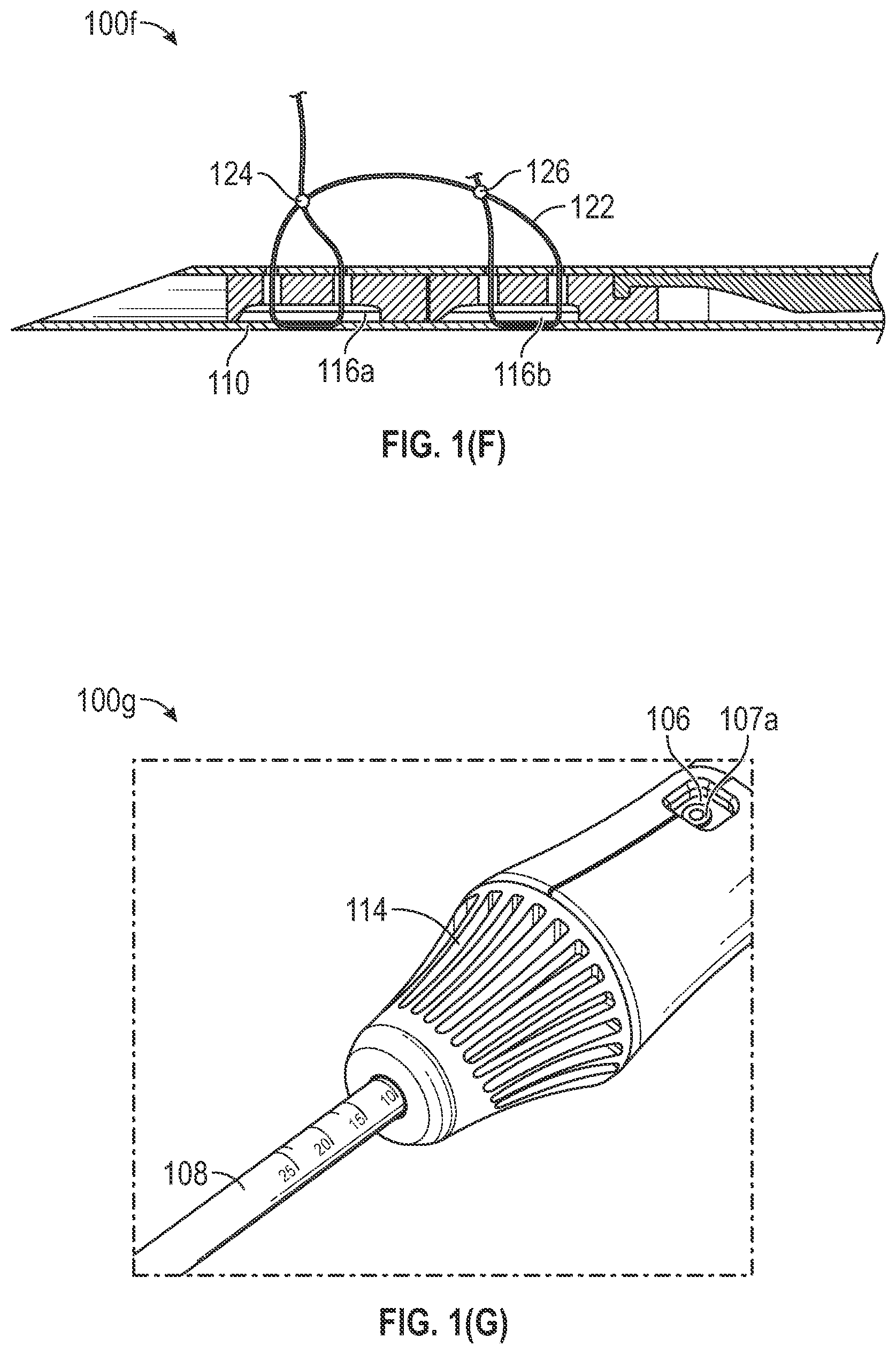 Patent US12102318 Figure 3 – Tissue repair device and method to repair tissue by deploying implants