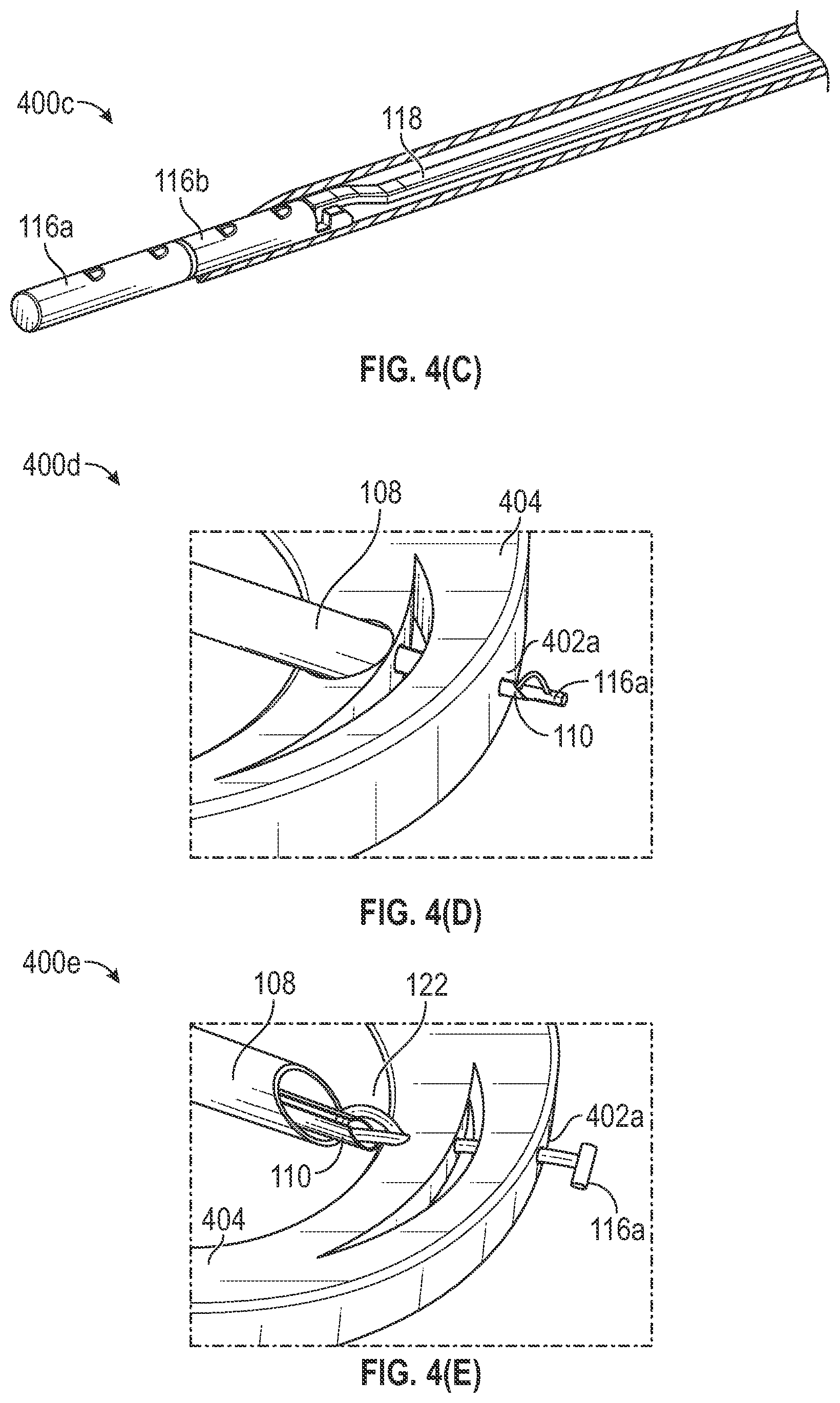 Patent US12102318 Figure 12 – Tissue repair device and method to repair tissue by deploying implants