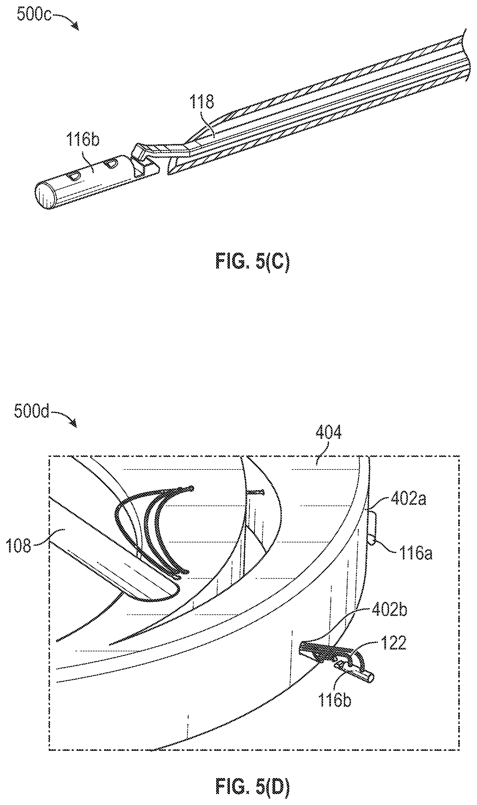 Patent US12102318 Figure 14 – Tissue repair device and method to repair tissue by deploying implants