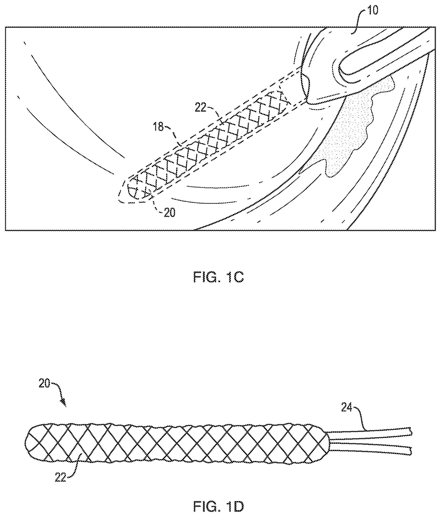 Patent US12102319 Figure 2 – Methods for measuring tissue defects