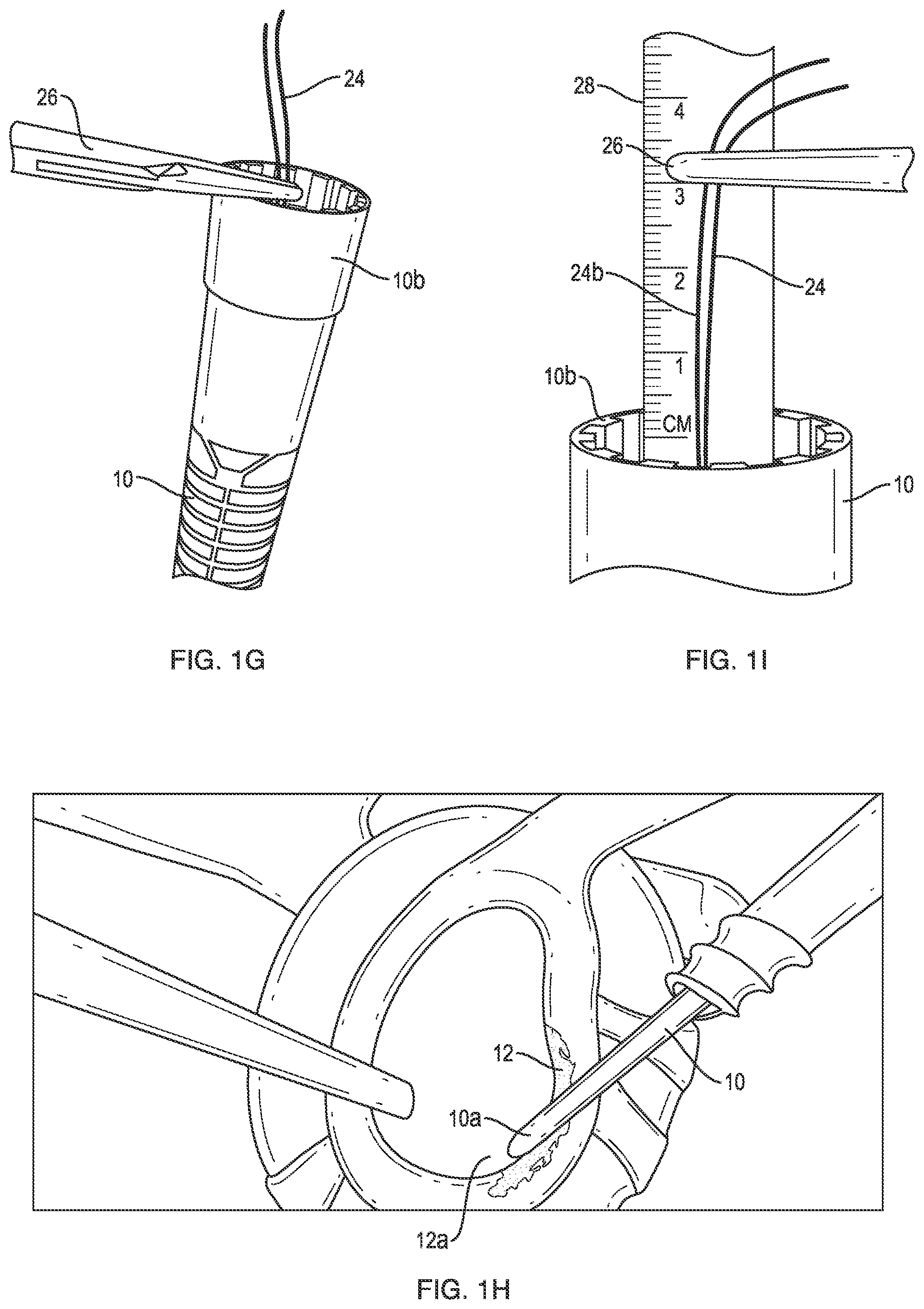 Patent US12102319 Figure 4 – Methods for measuring tissue defects