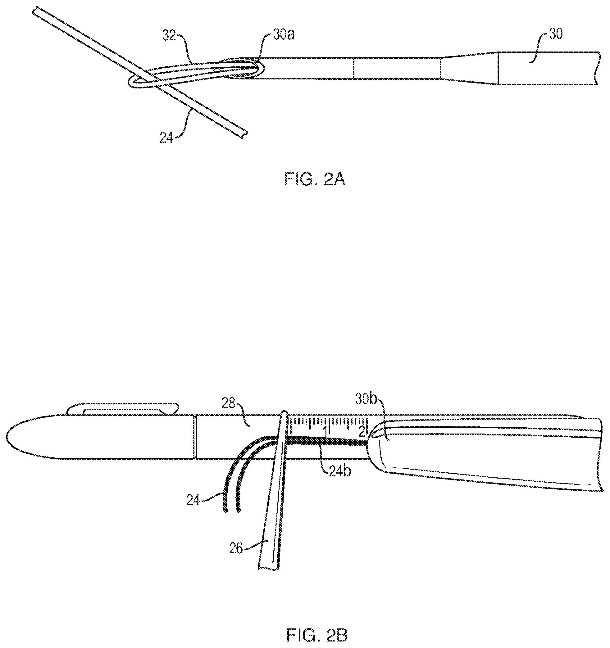 Patent US12102319 Figure 5 – Methods for measuring tissue defects