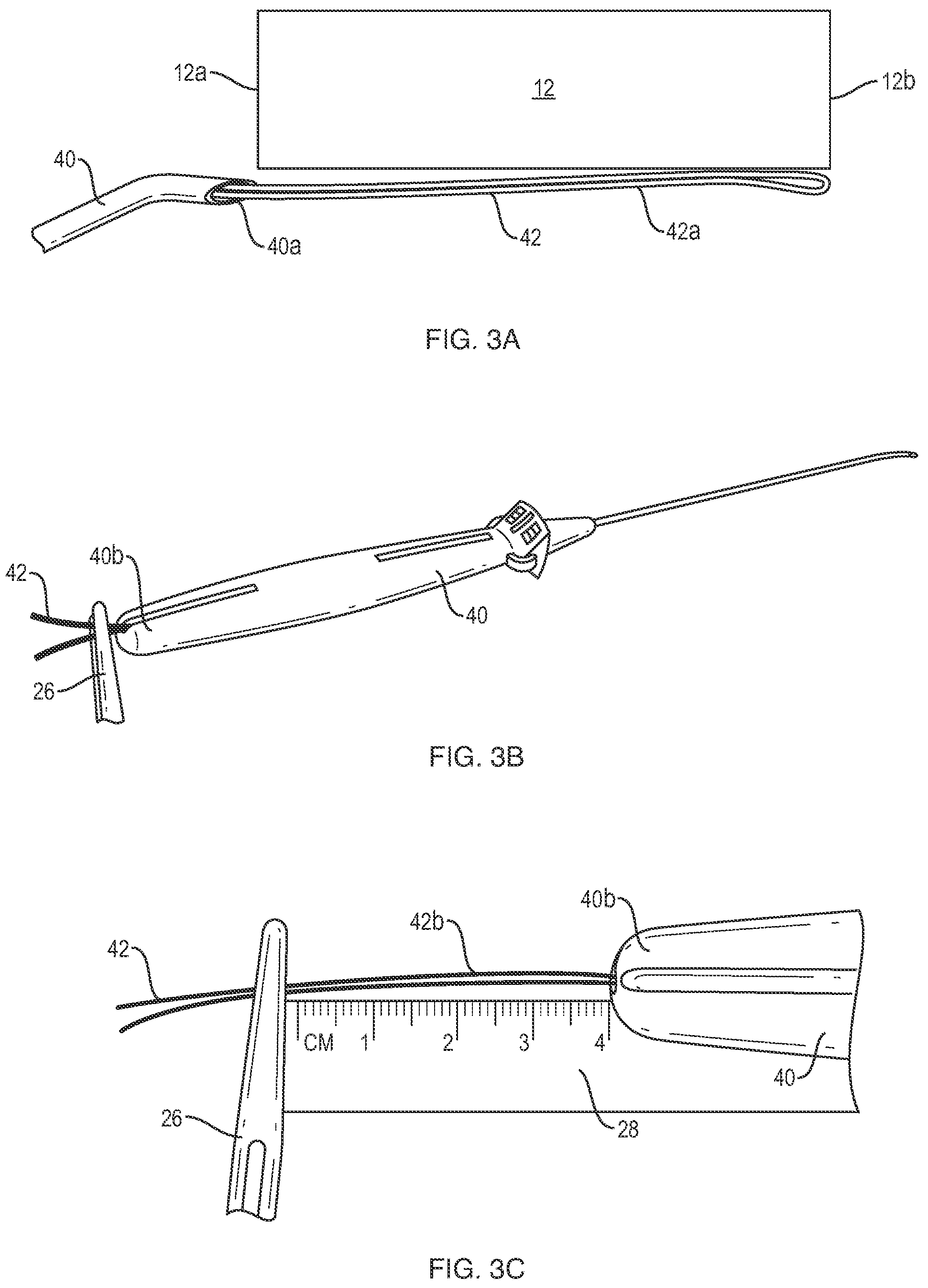 Patent US12102319 Figure 6 – Methods for measuring tissue defects