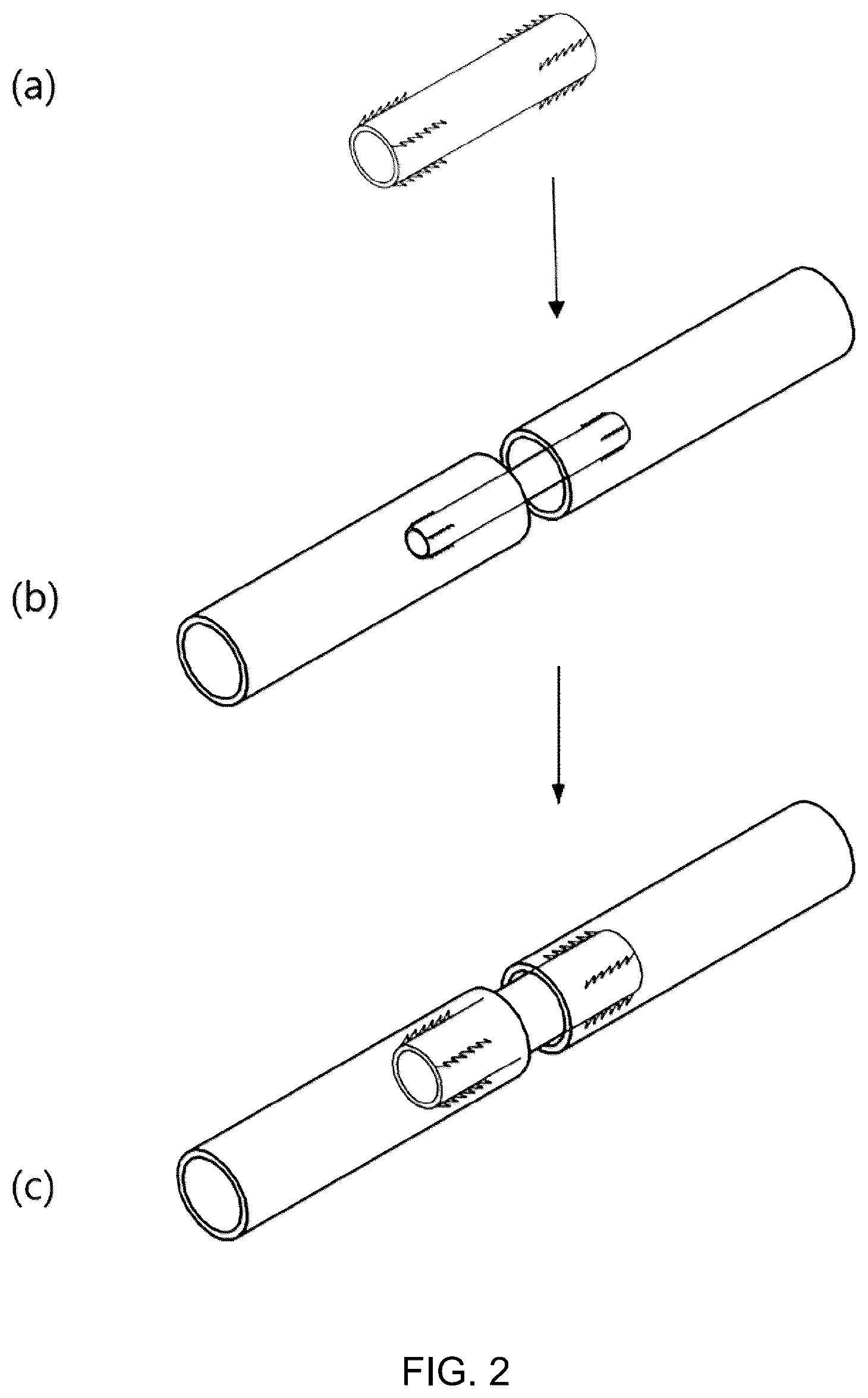 Patent US12102324 Figure 2 – Vascular anastomotic member comprising shape-memory polymer