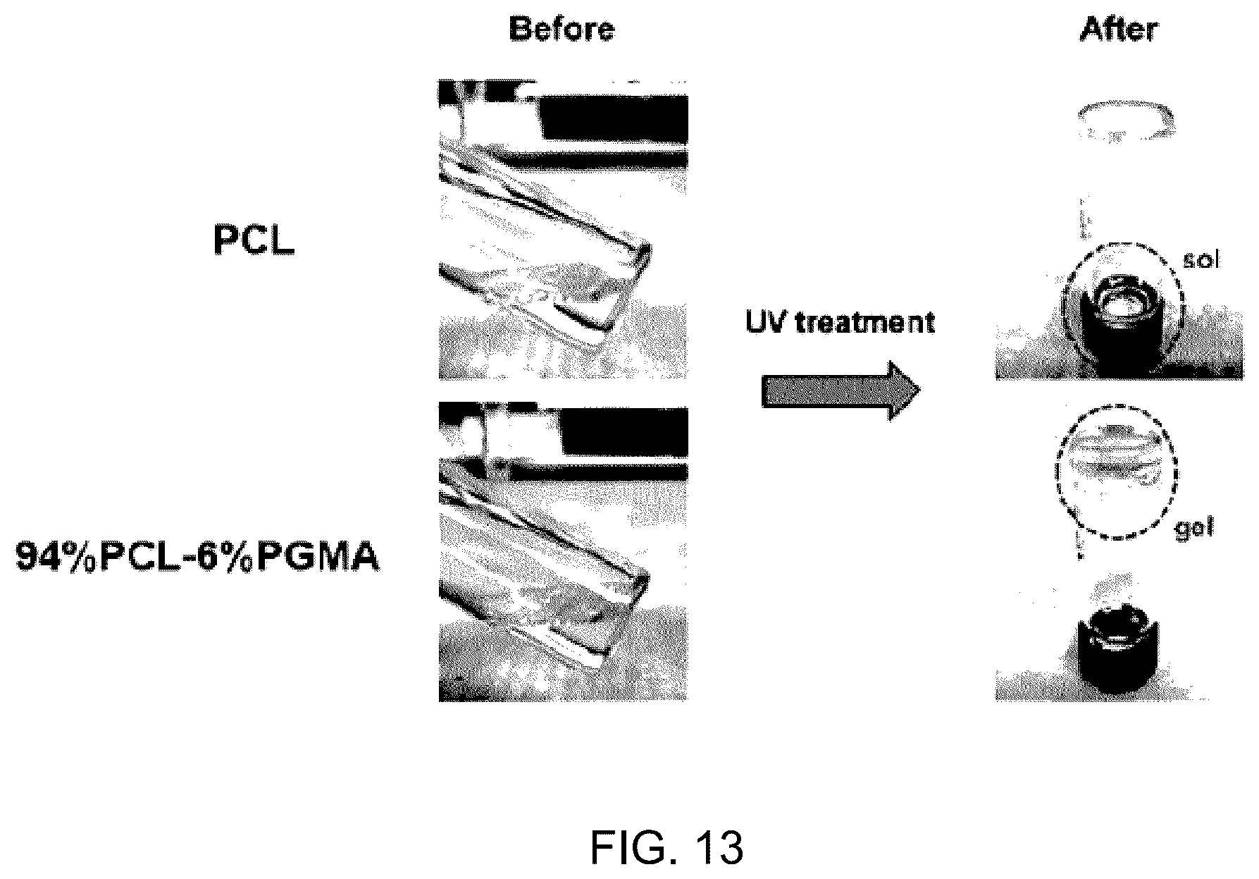 Patent US12102324 Figure 12 – Vascular anastomotic member comprising shape-memory polymer