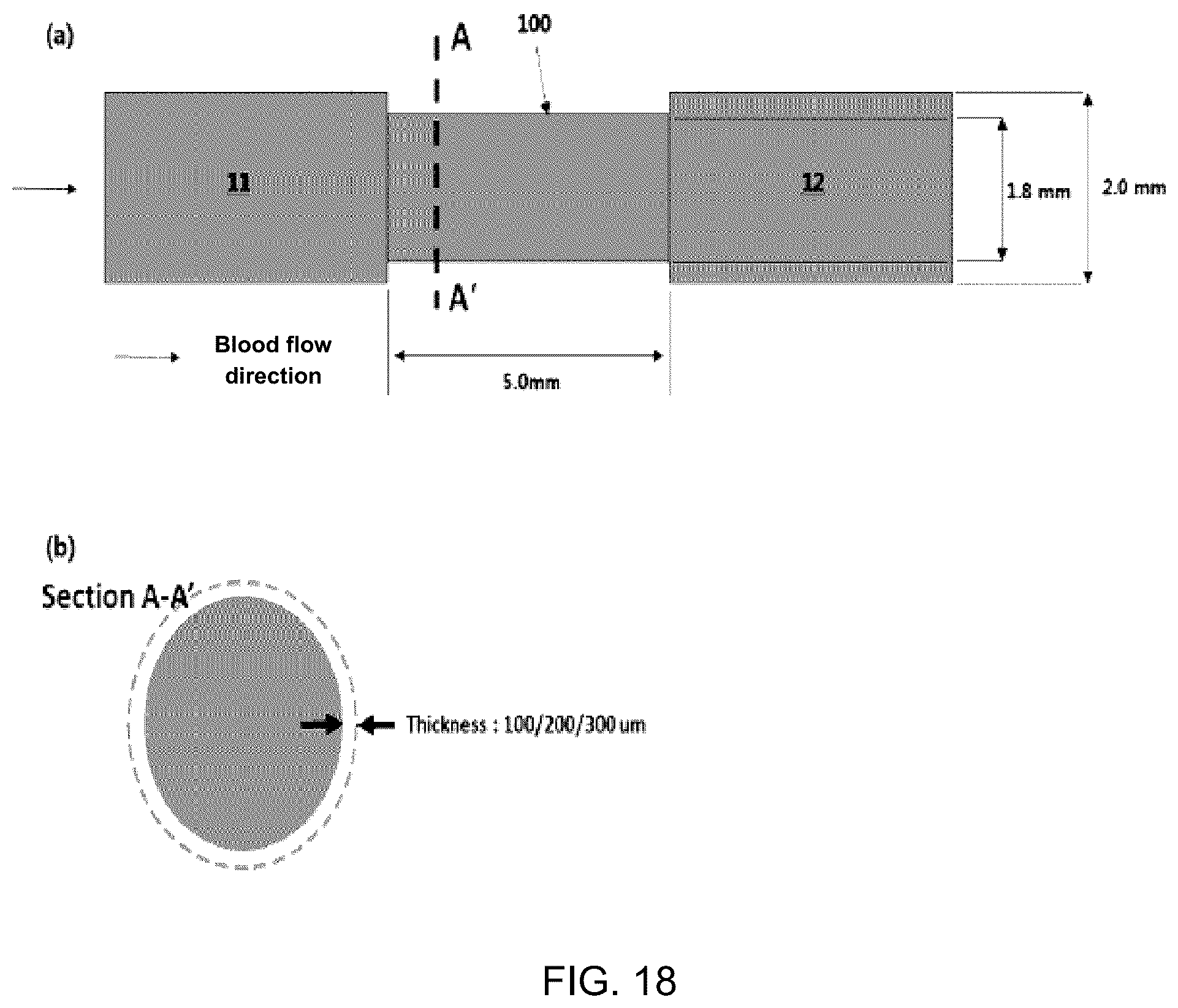 Patent US12102324 Figure 17 – Vascular anastomotic member comprising shape-memory polymer