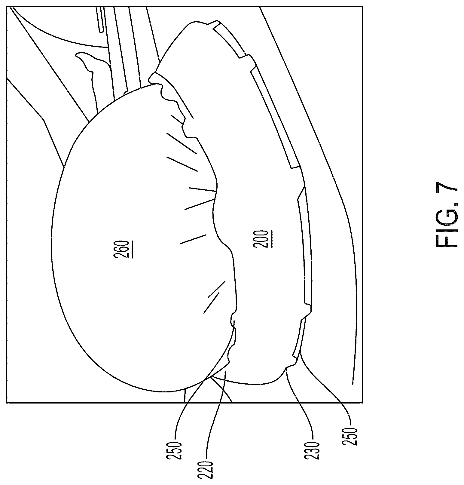 Patent US12102326 Figure 11 – Anti-slip ligation bands