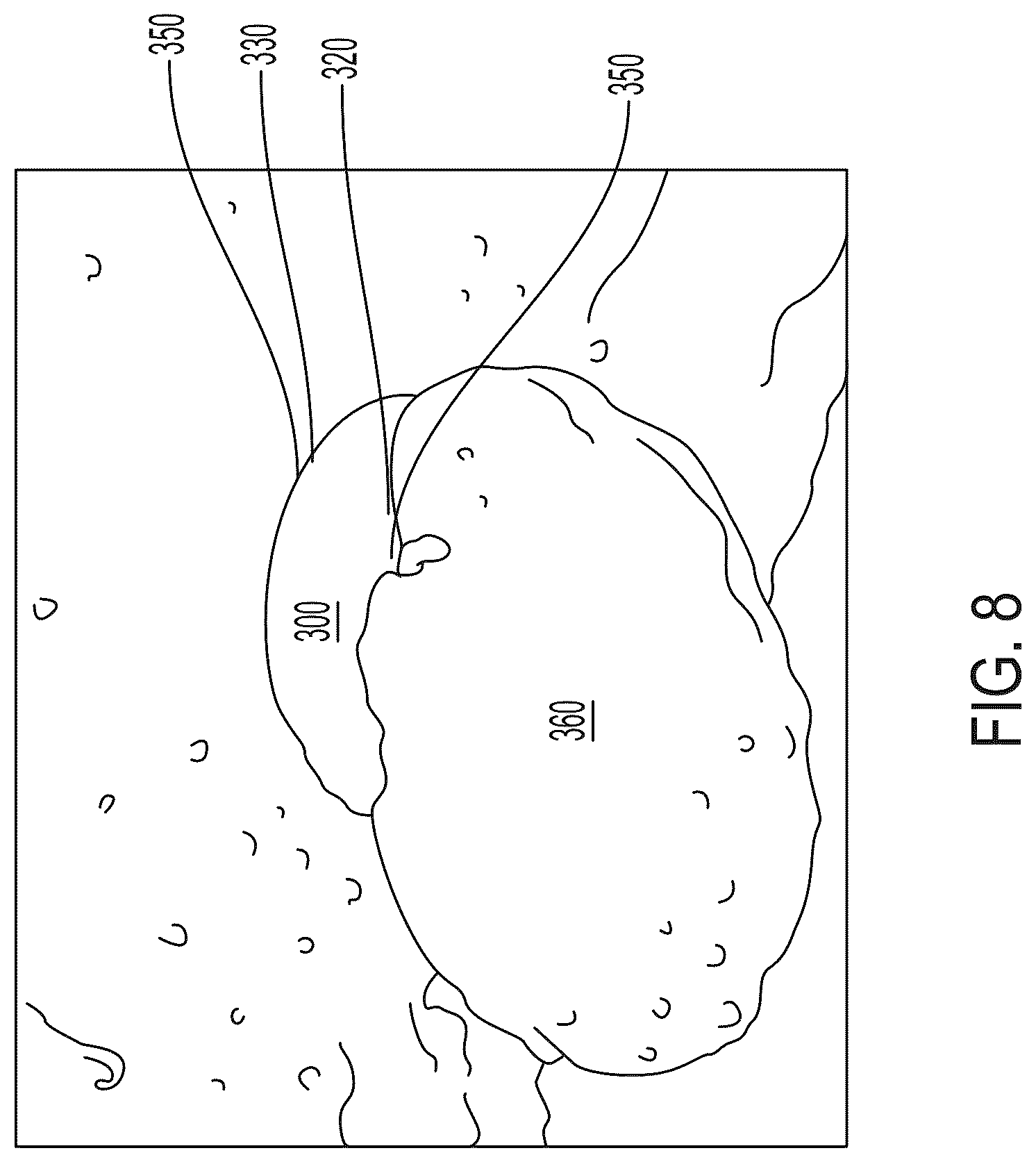 Patent US12102326 Figure 12 – Anti-slip ligation bands