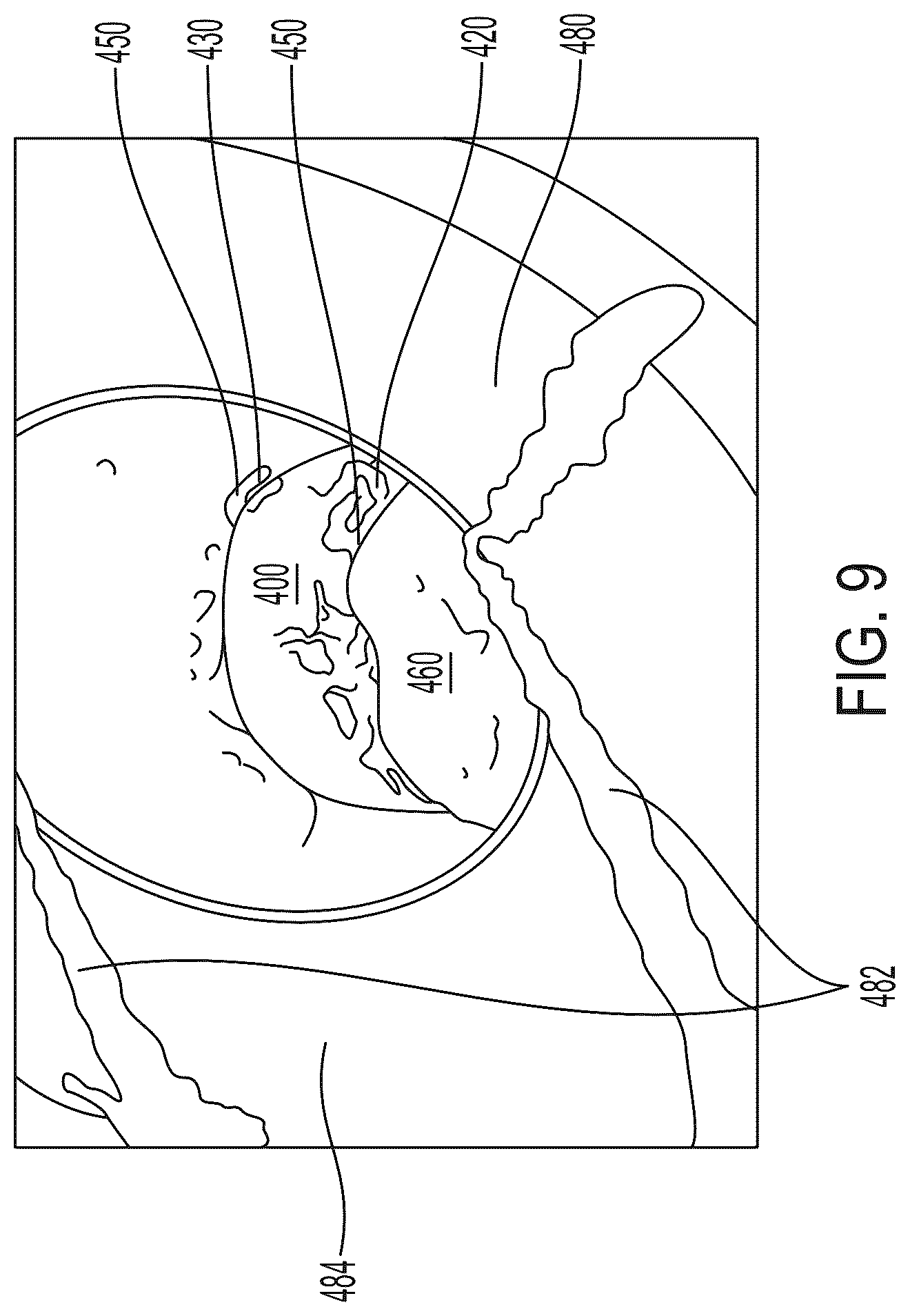 Patent US12102326 Figure 13 – Anti-slip ligation bands