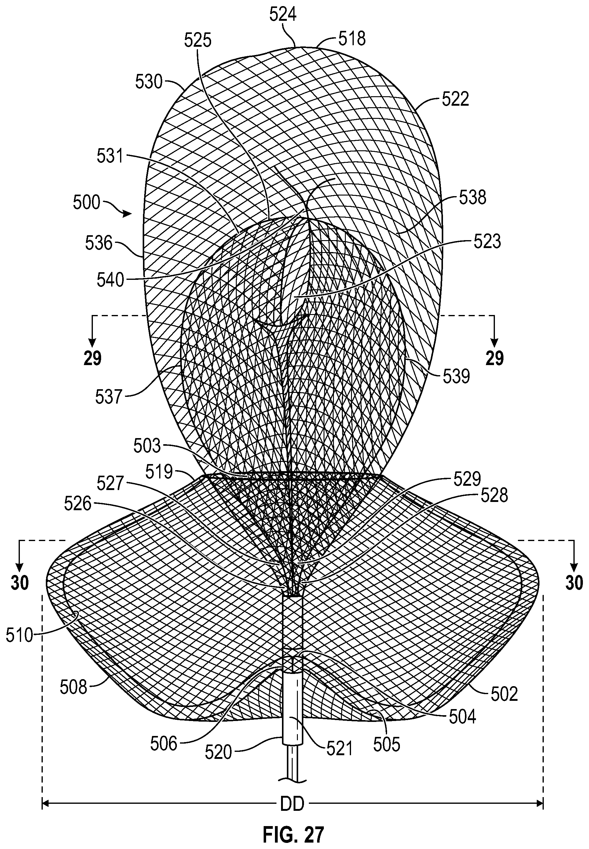 Patent US12102327 Figure 13 – Systems and methods for treating aneurysms
