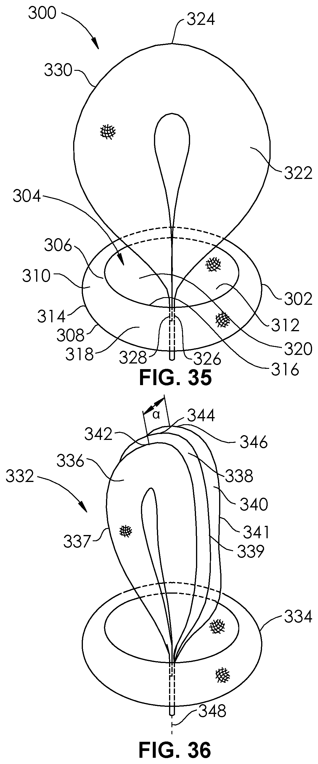 Patent US12102327 Figure 17 – Systems and methods for treating aneurysms