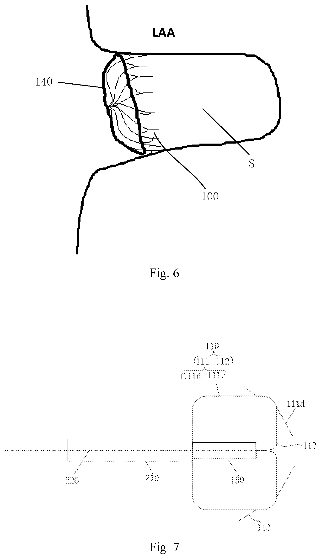 Patent US12102328 Figure 6 – Left atrial appendage occluder and left atrial appendage occlusion system