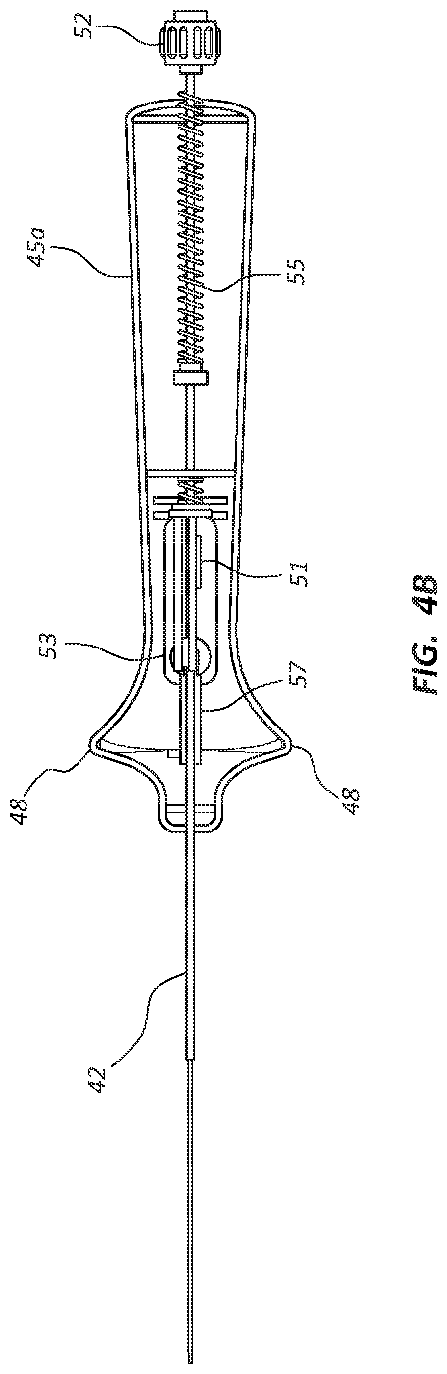 Patent US12102329 Figure 5 – Carotid artery embolic protection method using percutaneous transjugular carotid flow reversal