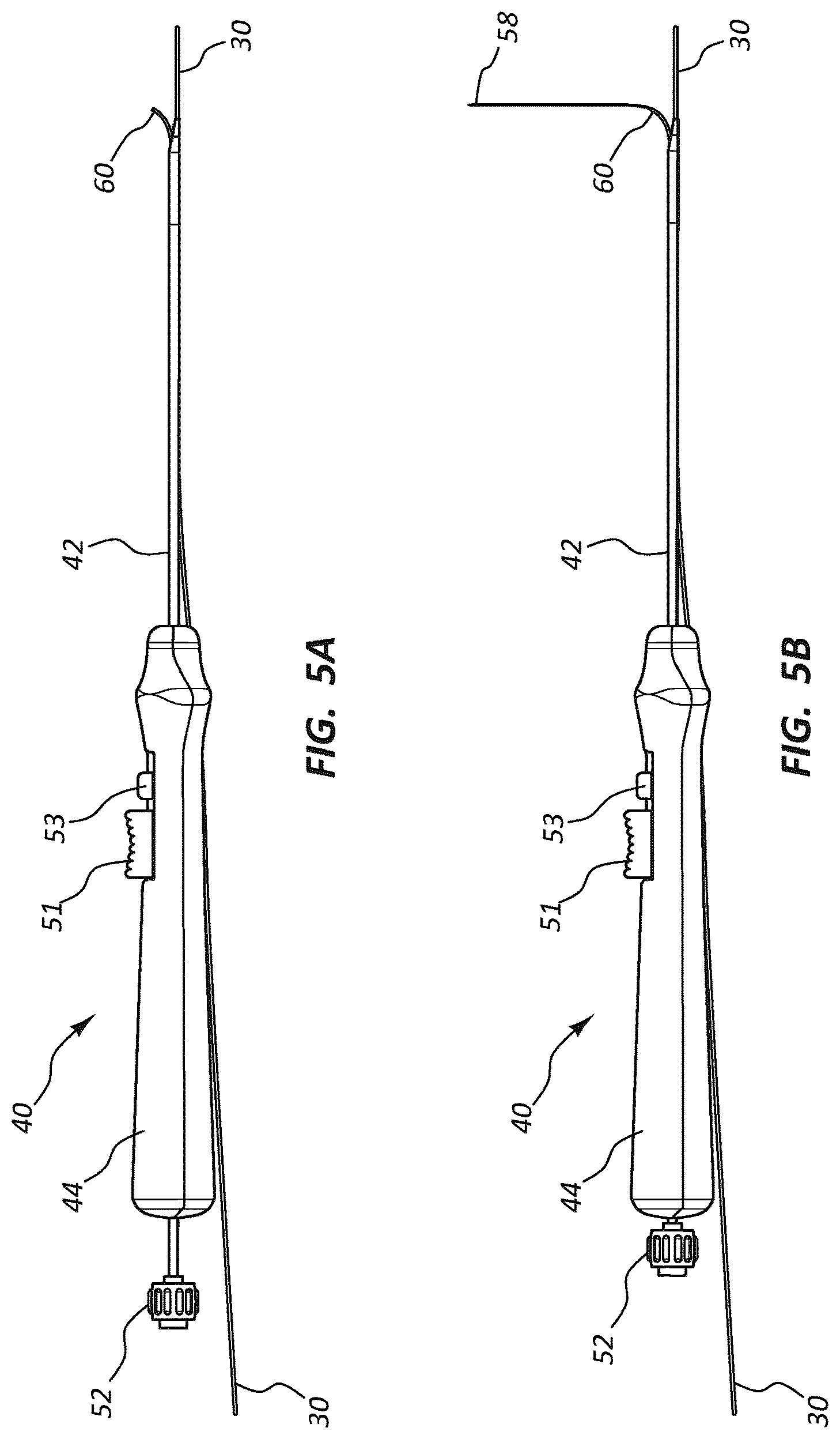 Patent US12102329 Figure 7 – Carotid artery embolic protection method using percutaneous transjugular carotid flow reversal