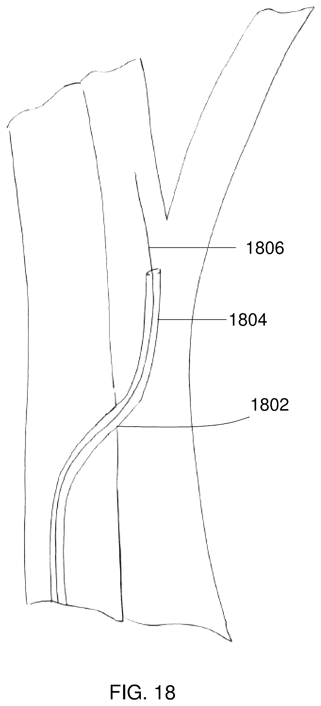 Patent US12102329 Figure 16 – Carotid artery embolic protection method using percutaneous transjugular carotid flow reversal