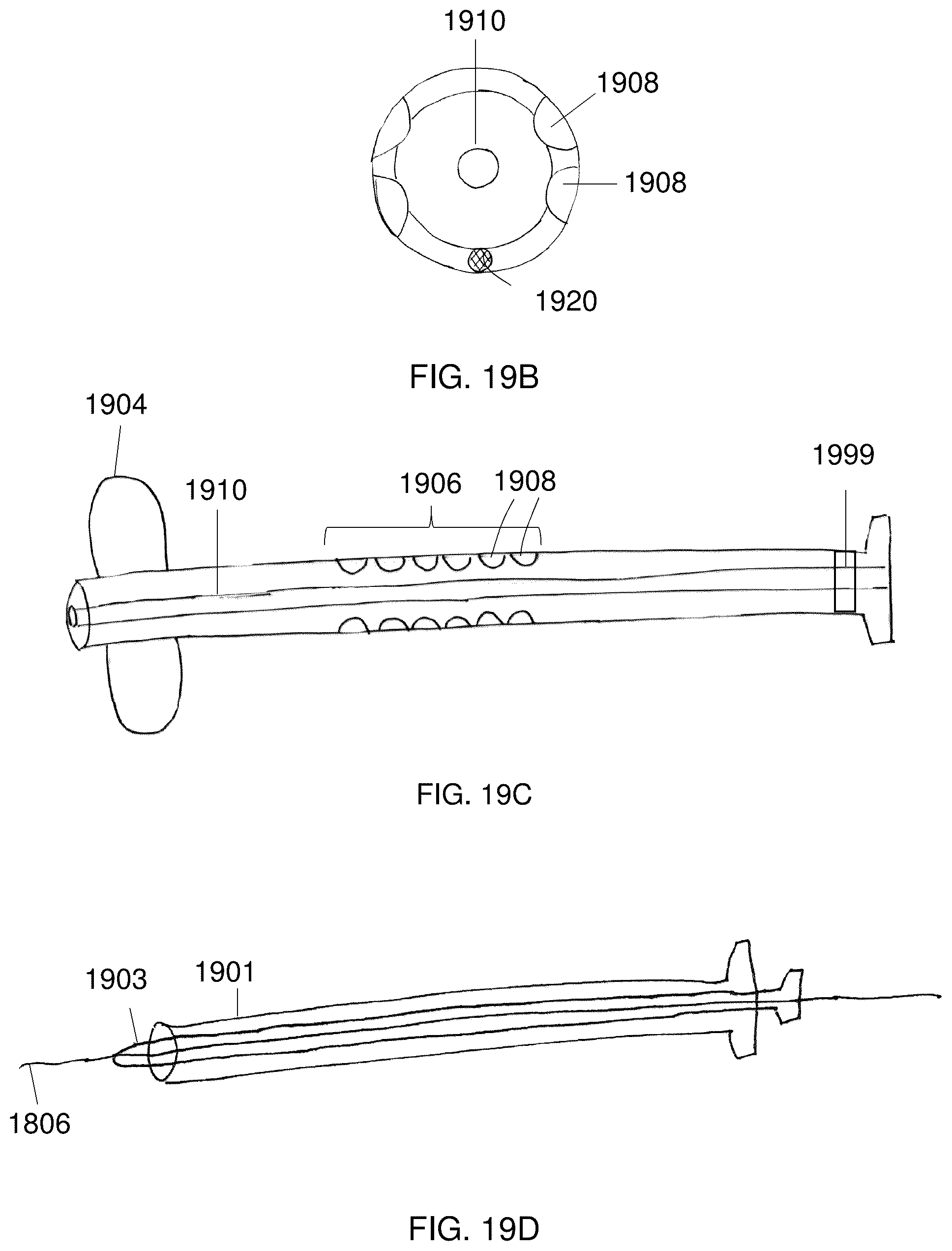 Patent US12102329 Figure 18 – Carotid artery embolic protection method using percutaneous transjugular carotid flow reversal