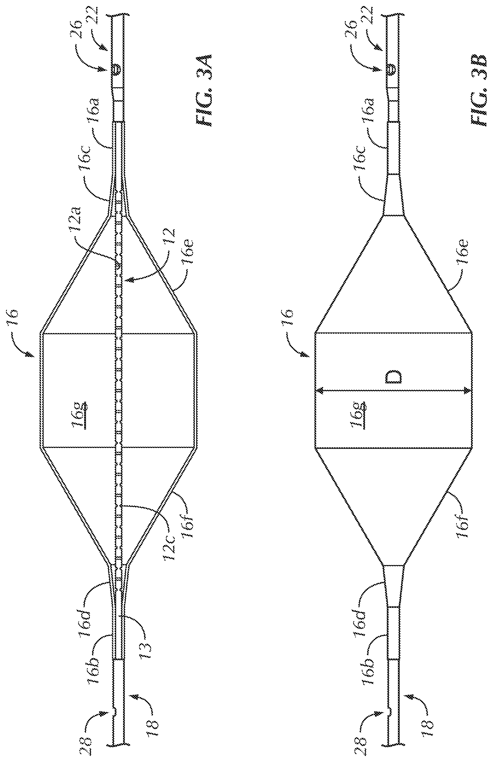 Patent US12102330 Figure 3 – Vascular occlusion catheter for partial occlusion or full occlusion