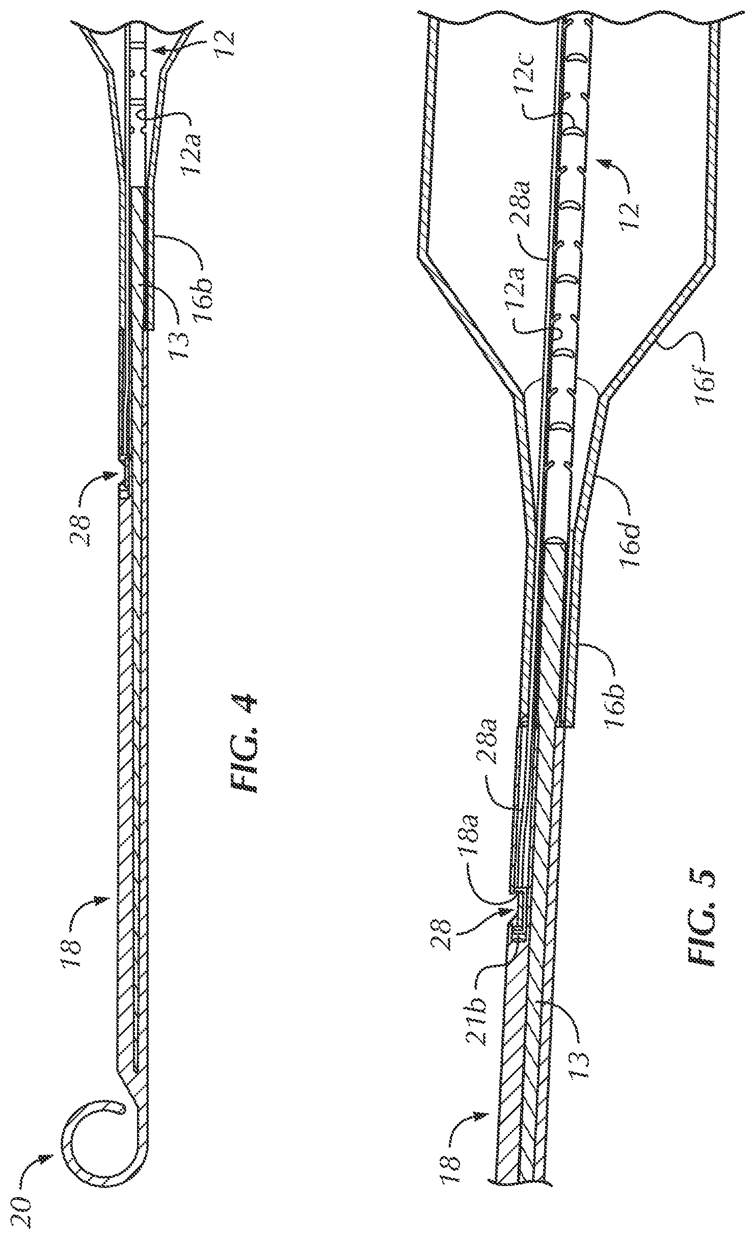 Patent US12102330 Figure 4 – Vascular occlusion catheter for partial occlusion or full occlusion
